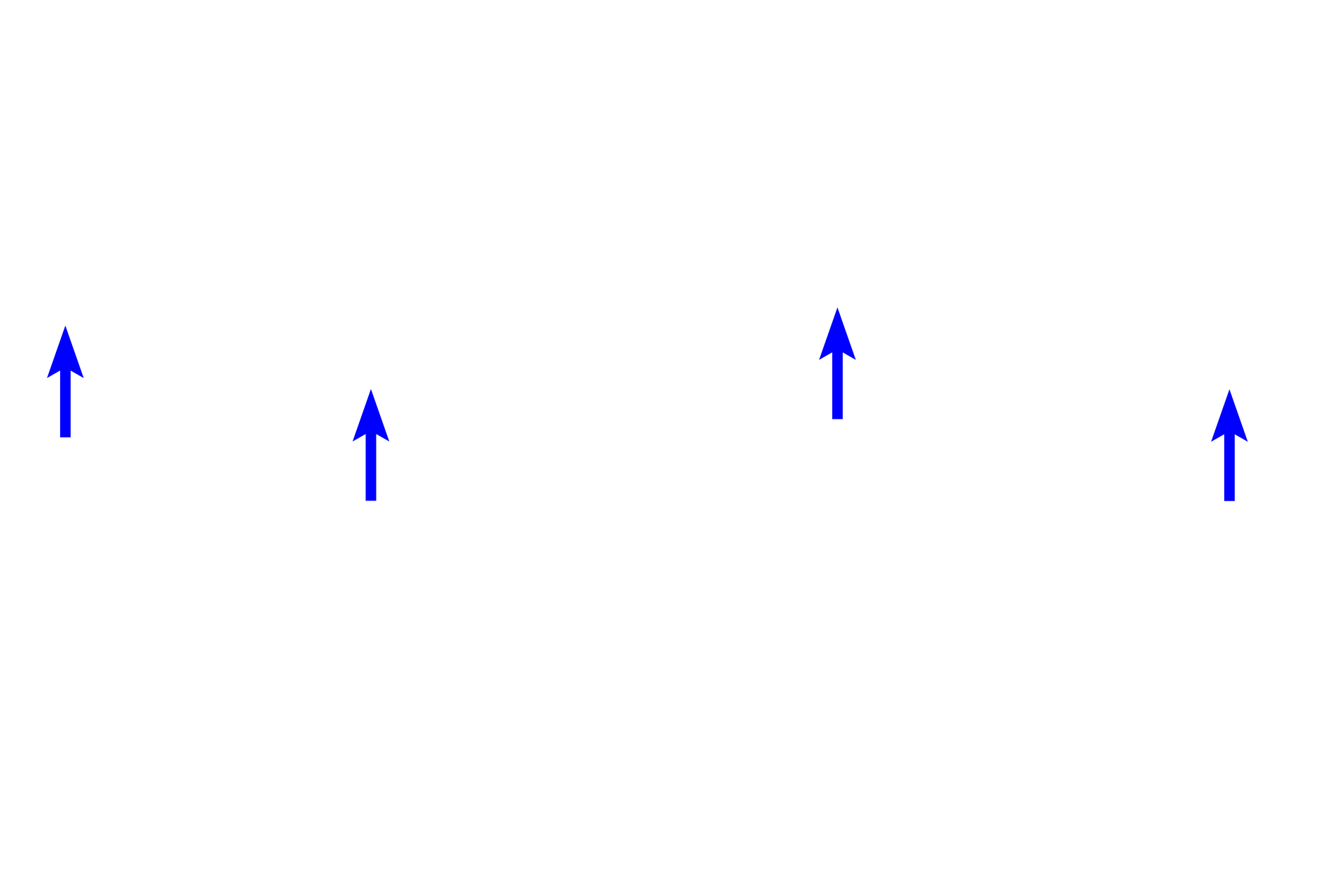  - Papillary layer of dermis <p>Skin can be classified as either thick or thin, depending on the thickness of the epidermal layer.  A diagrammatic representation of thin skin and a photomicrograph of a H&E stained section illustrate the reduced thickness of the strata in thin skin and the absence of stratum lucidum as a distinct layer.  400x</p>
