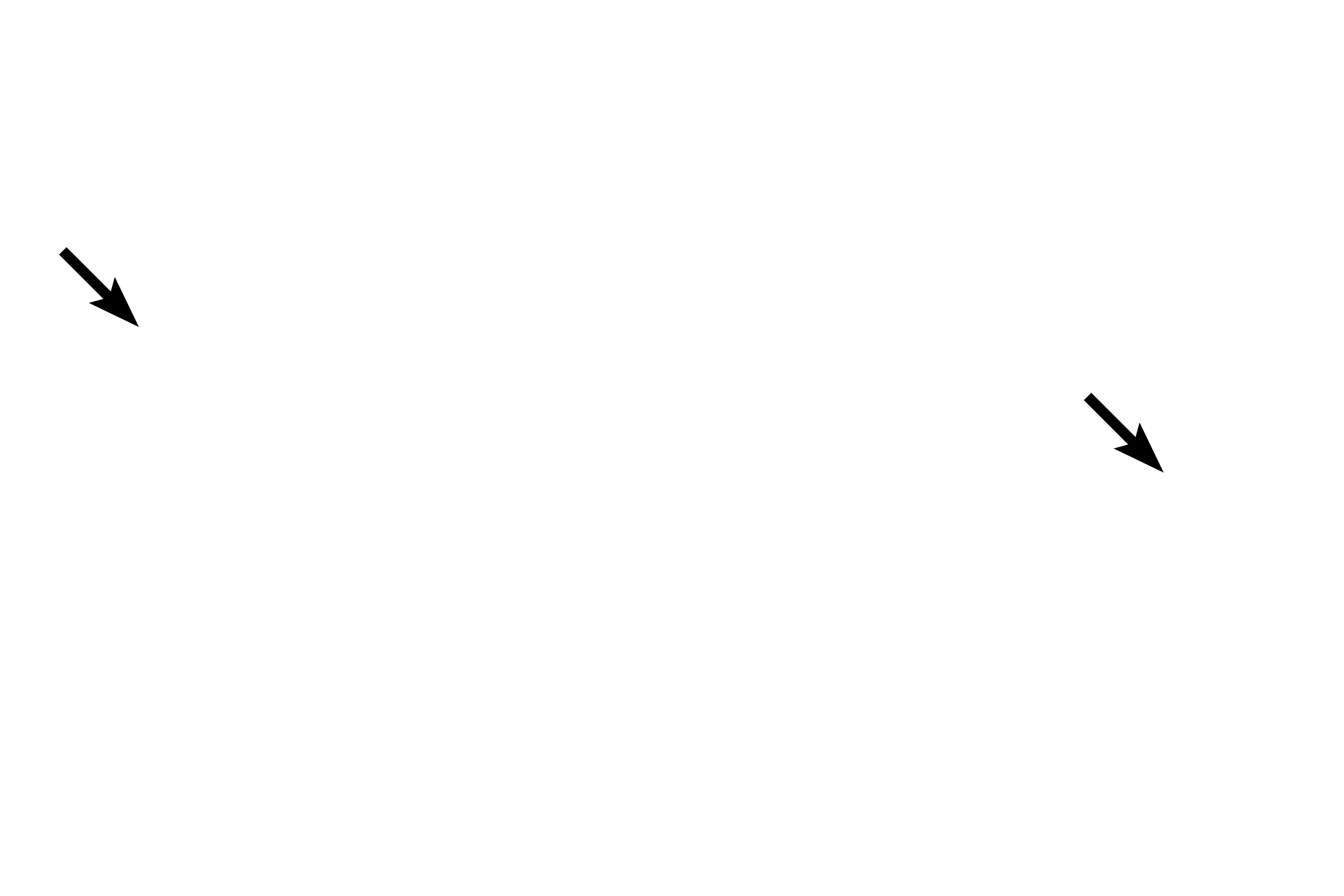 Meissner's corpuscles <p>Meissner’s corpuscles are encapsulated sensory receptors located at the apex of sensory dermal papillae. These receptors provide fine touch discrimination and are most concentrated in the finger tips and lips. Other dermal papillae contain blood vessels and are called vascular papillae.  200x</p>
