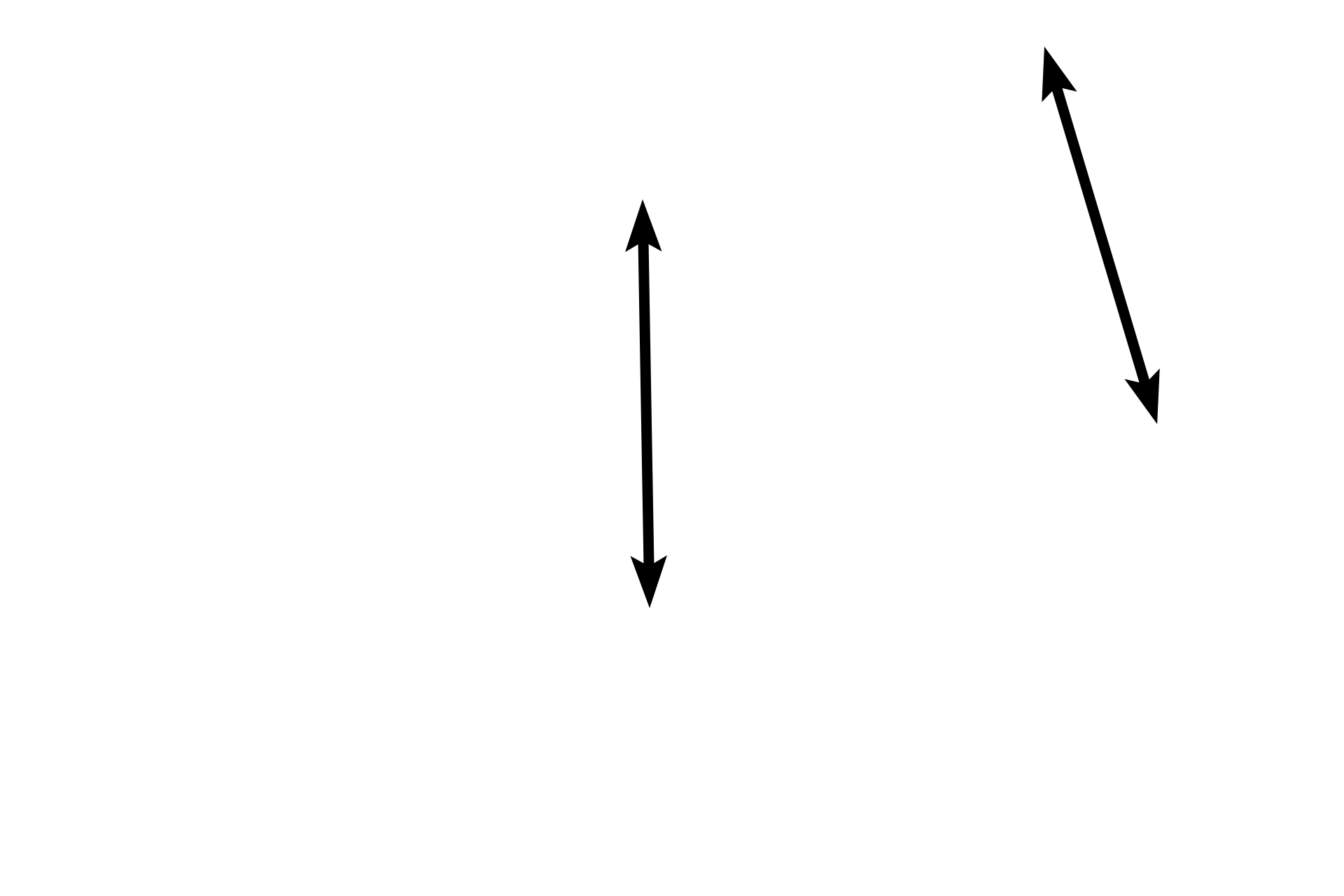 Mucosa > <p>The mucosal lining of the gall bladder is thrown into convoluted, branching folds as well infoldings into the deeper layers. The lining epithelium is simple columnar and possesses numerous, short microvilli.</p>
