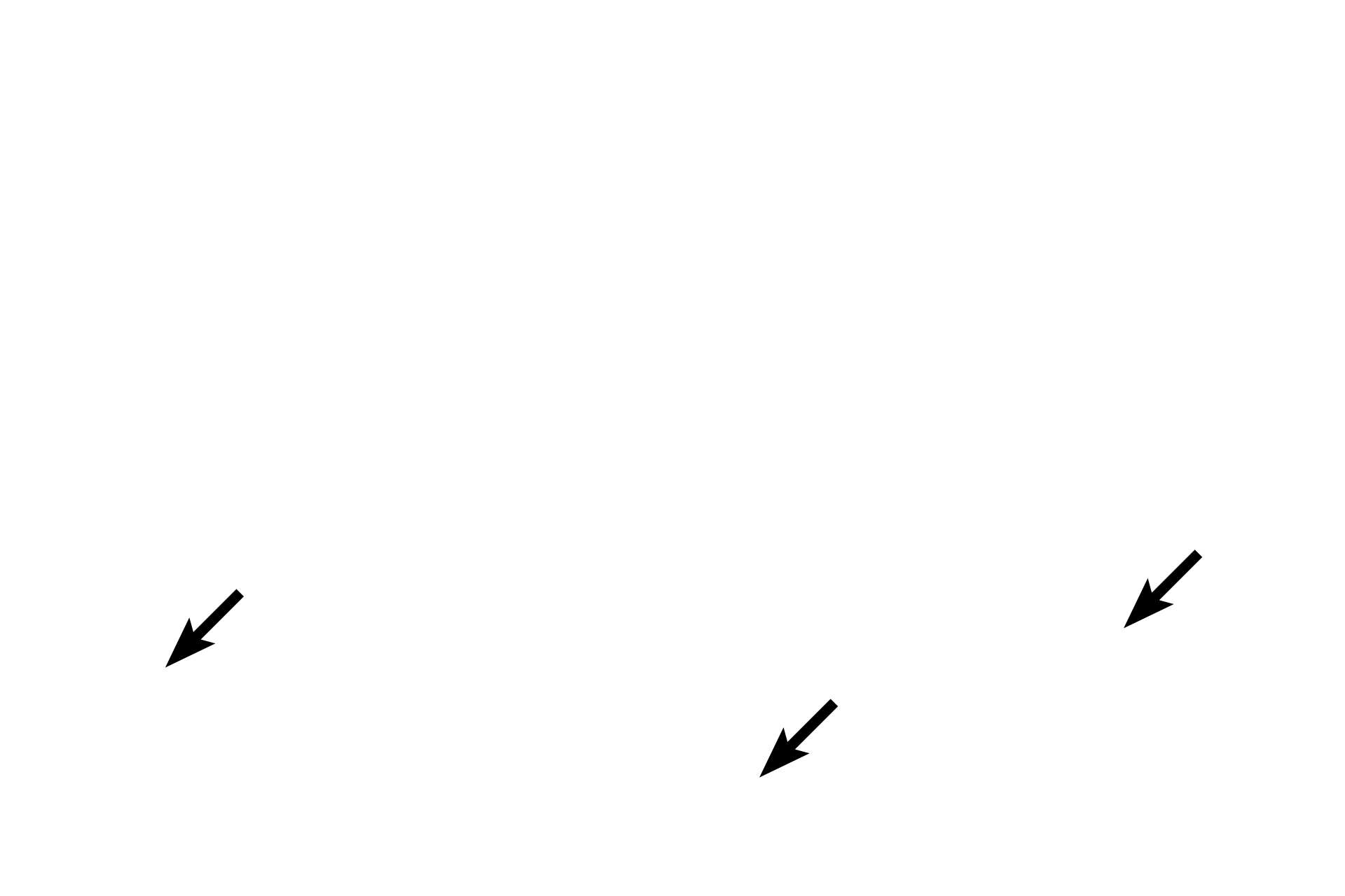 Serosa > <p>Where the gall bladder is not in contact with the liver, it is covered by a serosa with a thick subserosal layer of connective tissue, containing numerous large blood vessels.</p>
