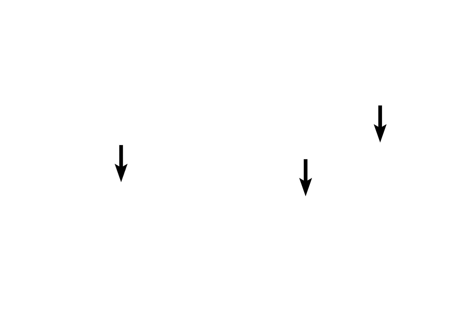 - Infoldings <p>The mucosal lining of the gall bladder is thrown into convoluted, branching folds as well infoldings into the deeper layers. The lining epithelium is simple columnar and possesses numerous, short microvilli.</p>
