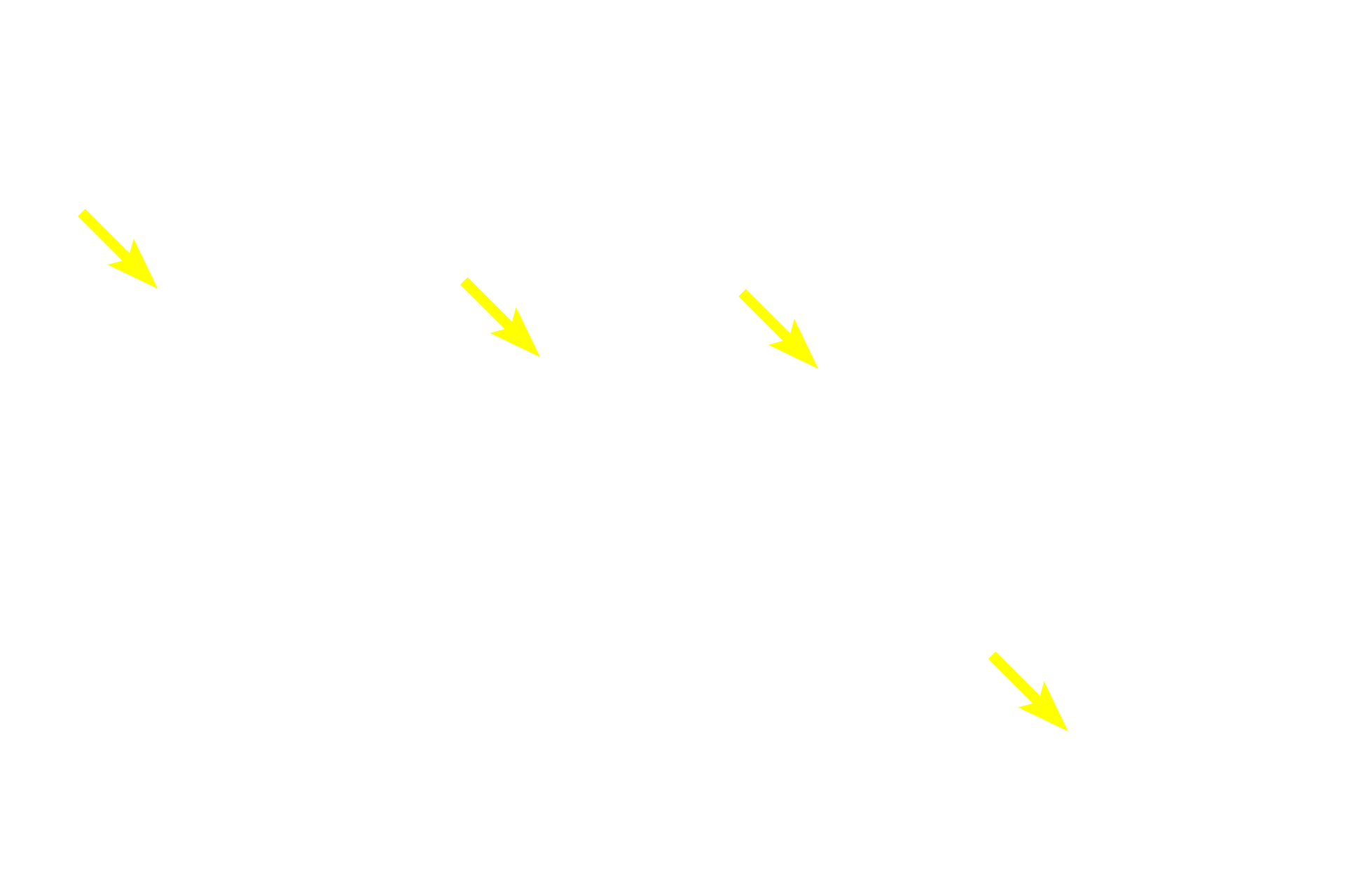 Lamina propria <p>The mucosa of the gall bladder is extensively infolded, particularly when the gall bladder is empty.  Simple columnar epithelium with short microvilli lines the lumen and the infoldings.  200X</p>

