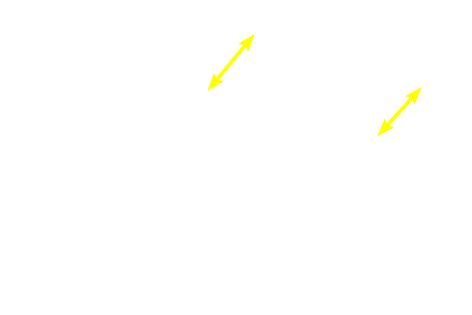 Simple columnar epithelium <p>Simple columnar epithelium lines the surface of the gall bladder.  Cell nuclei tend to be basally located and the apical surface possesses numerous, short microvilli.  The lamina propria, located beneath the epithelium, is quite cellular, including cells of the lymphoid series.  400x</p>
