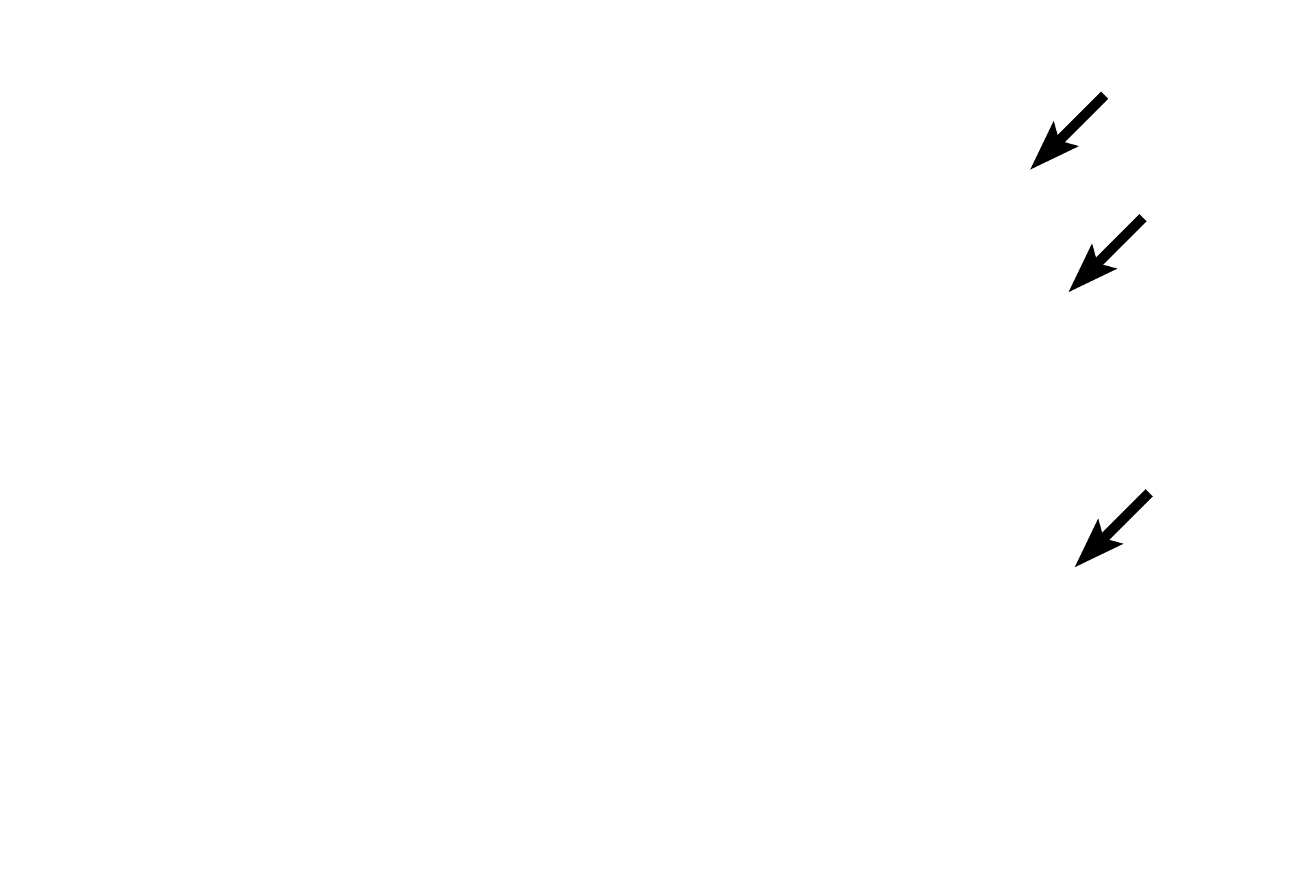  - Location of mitochondria and granules <p>The epithelium lining the gall bladder is simple columnar with short microvilli; its oval nuclei are located in the lower one-third of each cell.  The apical cytoplasm is filled with mitochondria which supply energy to concentrate the bile as well as secretory granules containing mucinogen.  Additional mucus is added to the bile by the larger bile ducts.  1000x</p>
