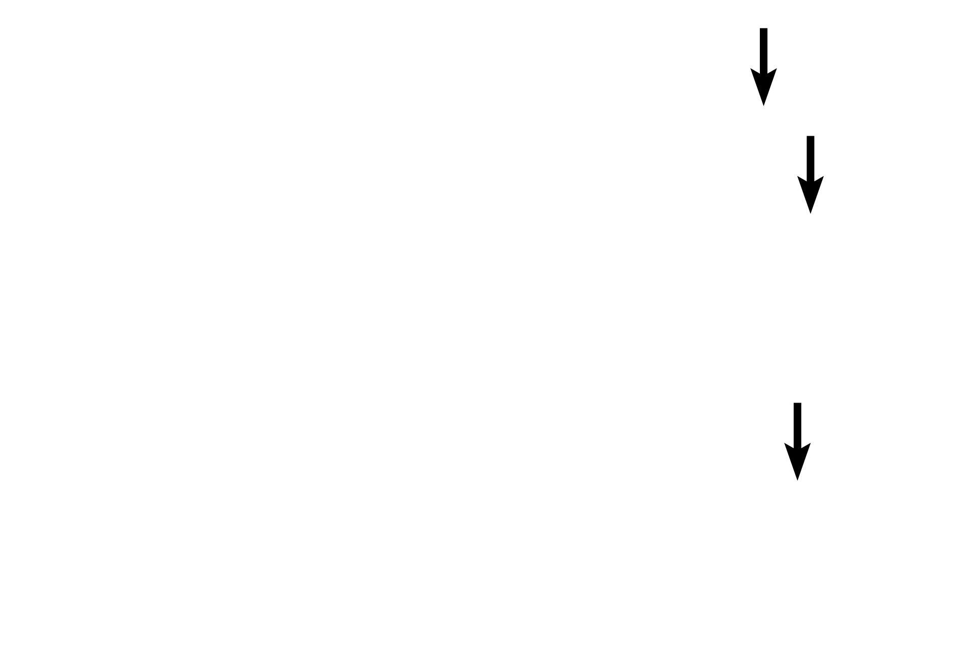  - Microvilli <p>The epithelium lining the gall bladder is simple columnar with short microvilli; its oval nuclei are located in the lower one-third of each cell.  The apical cytoplasm is filled with mitochondria which supply energy to concentrate the bile as well as secretory granules containing mucinogen.  Additional mucus is added to the bile by the larger bile ducts.  1000x</p>
