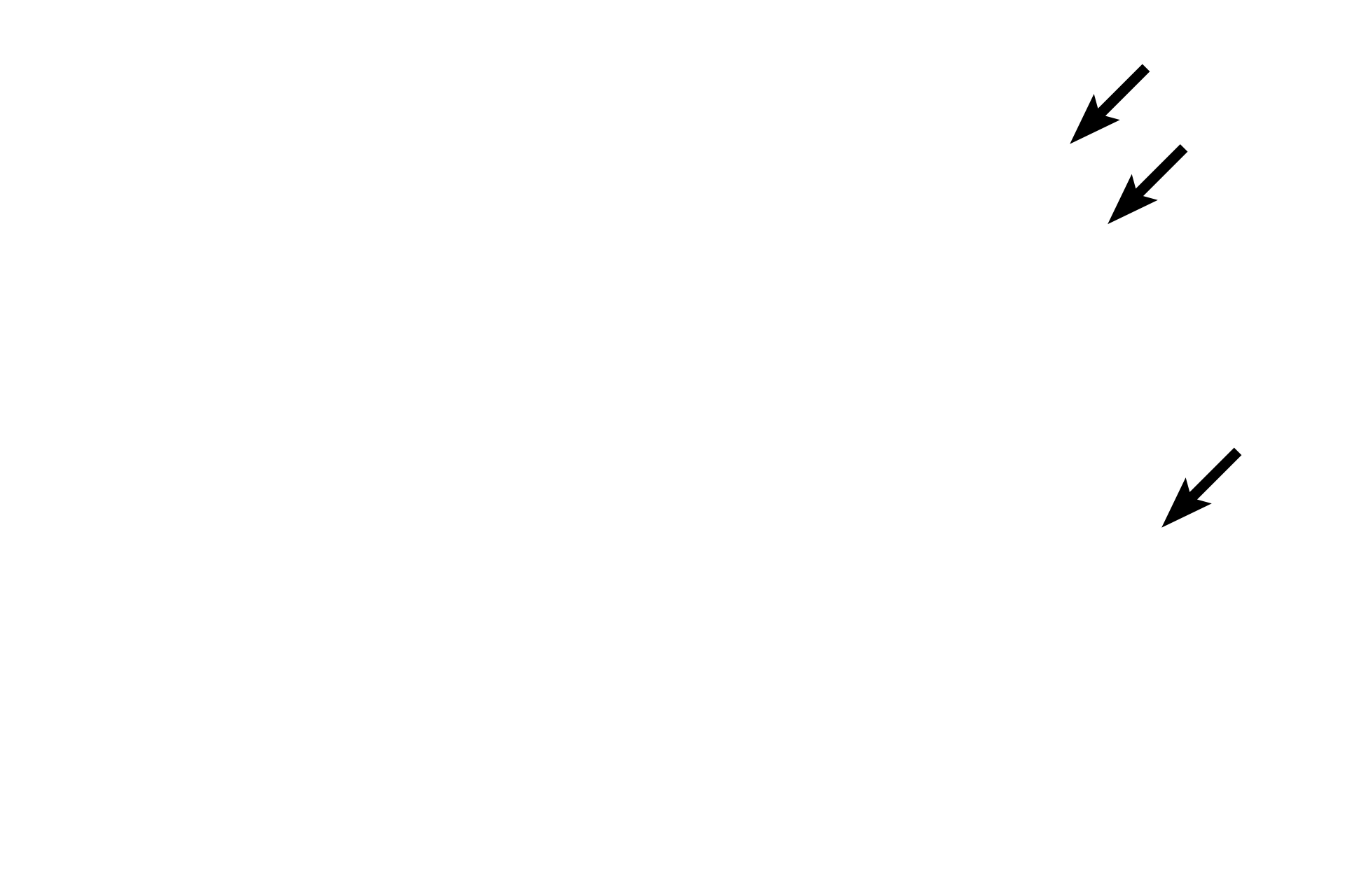 Mucus <p>The epithelium lining the gall bladder is simple columnar with short microvilli; its oval nuclei are located in the lower one-third of each cell.  The apical cytoplasm is filled with mitochondria which supply energy to concentrate the bile as well as secretory granules containing mucinogen.  Additional mucus is added to the bile by the larger bile ducts.  1000x</p>
