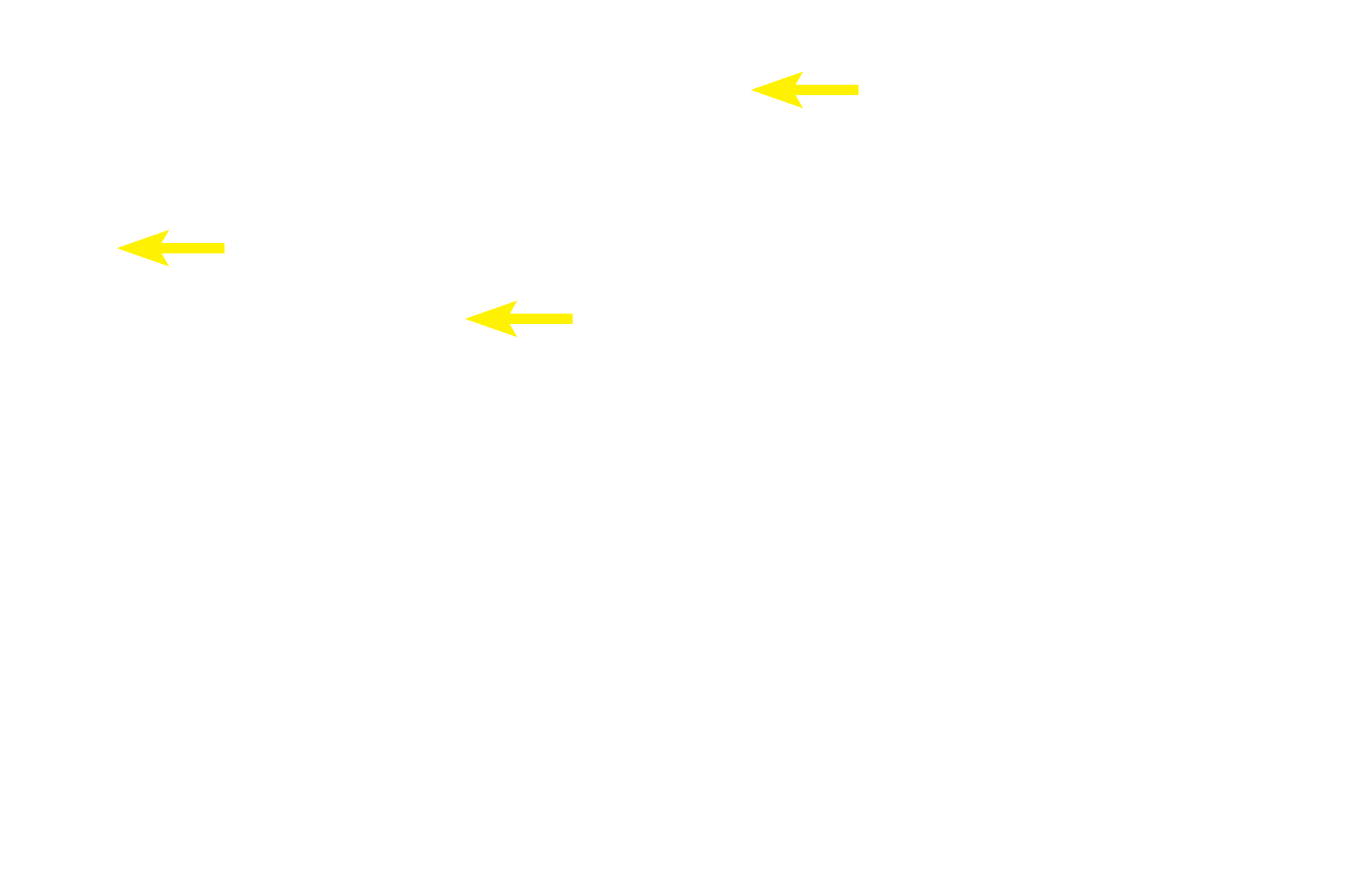  - Secretory granules <p>This gall bladder epithelium contains numerous, mucinogen-filled secretory granules.  Additional mucus is added to the bile by mucous glands in the lamina propria and by goblet cells in the larger bile ducts.  1000x</p>
