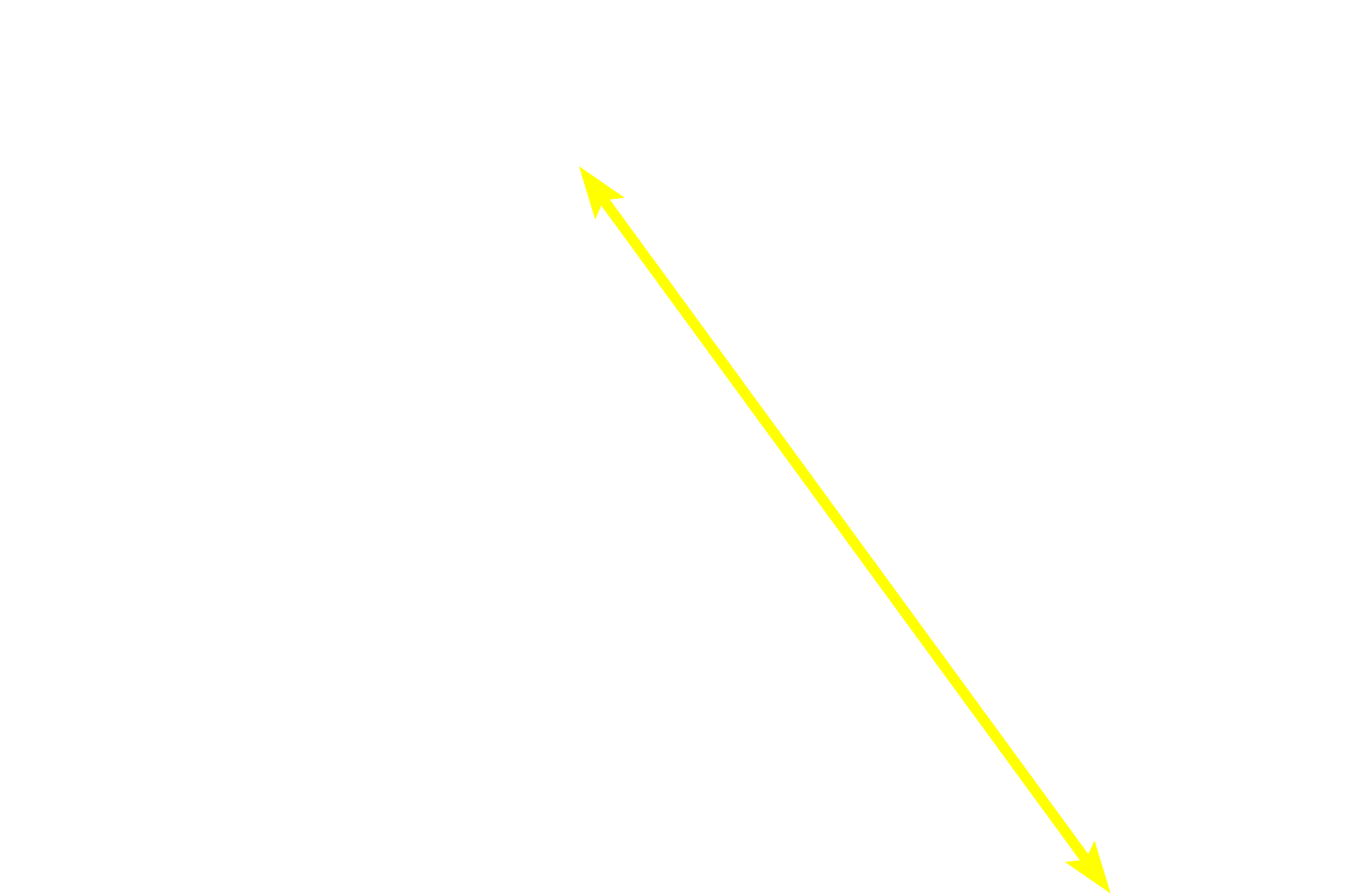 Muscularis externa <p>The muscularis external shows the interlacing bundles of longitudinal, transverse and oblique smooth muscle, as well as intervening connective tissue.  Both a muscularis mucosae and a submucosa are absent in the gall bladder.  400x</p>
