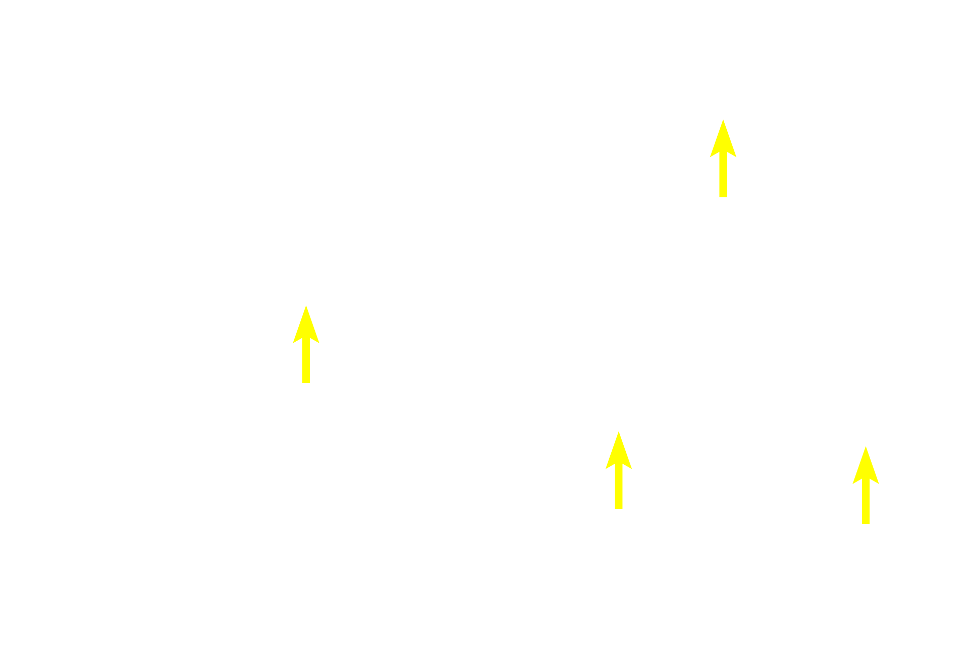 - Smooth muscle fascicles <p>The muscularis external shows the interlacing bundles of longitudinal, transverse and oblique smooth muscle, as well as intervening connective tissue.  Both a muscularis mucosae and a submucosa are absent in the gall bladder.  400x</p>
