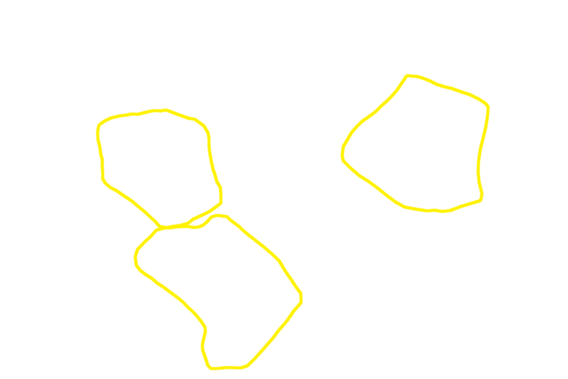 Liver lobules > <p>The lobule, the basic structure of the liver, is formed by anastomosing rows of hepatocytes and intervening sinusoids, which extend from the periphery of the lobule toward a central vein. Portal canals, located at the marginal angles around the perimeter of the lobule, contain branches of the hepatic portal vein, hepatic artery and bile duct. This image of pig liver shows bands of connective tissue outlining lobules; these distinctions are not so obvious in the human. </p>
