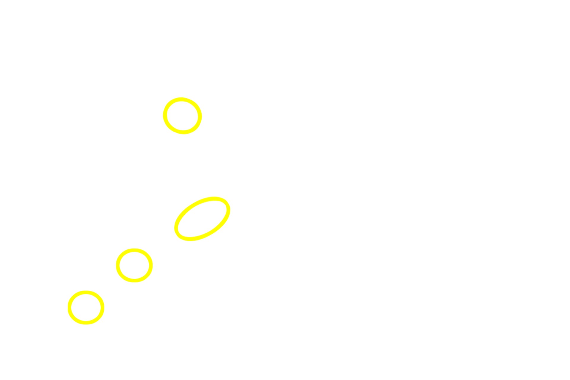  - Portal canals <p>The lobule, the basic structure of the liver, is formed by anastomosing rows of hepatocytes and intervening sinusoids, which extend from the periphery of the lobule toward a central vein. Portal canals, located at the marginal angles around the perimeter of the lobule, contain branches of the hepatic portal vein, hepatic artery and bile duct. This image of pig liver shows bands of connective tissue outlining lobules; these distinctions are not so obvious in the human. </p>
