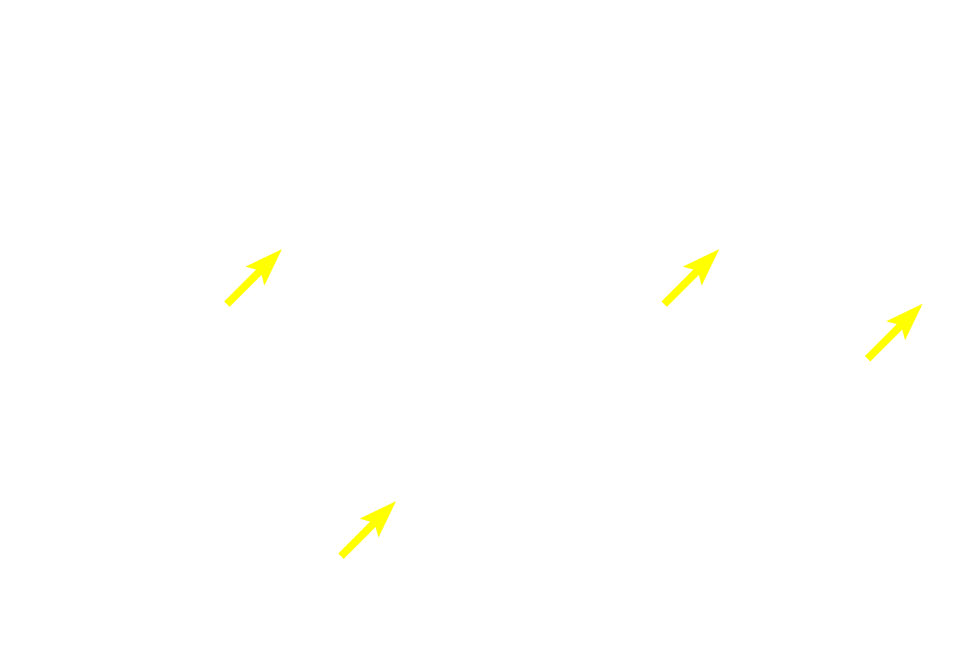  - Central veins <p>The lobule, the basic structure of the liver, is formed by anastomosing rows of hepatocytes and intervening sinusoids, which extend from the periphery of the lobule toward a central vein. Portal canals, located at the marginal angles around the perimeter of the lobule, contain branches of the hepatic portal vein, hepatic artery and bile duct. This image of pig liver shows bands of connective tissue outlining lobules; these distinctions are not so obvious in the human. </p>
