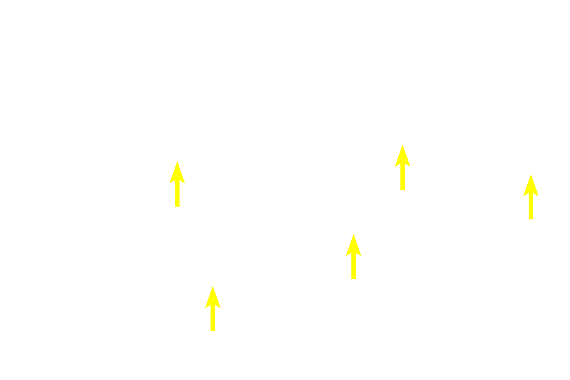  - Hepatocytes <p>The lobule, the basic structure of the liver, is formed by anastomosing rows of hepatocytes and intervening sinusoids, which extend from the periphery of the lobule toward a central vein. Portal canals, located at the marginal angles around the perimeter of the lobule, contain branches of the hepatic portal vein, hepatic artery and bile duct. This image of pig liver shows bands of connective tissue outlining lobules; these distinctions are not so obvious in the human. </p>
