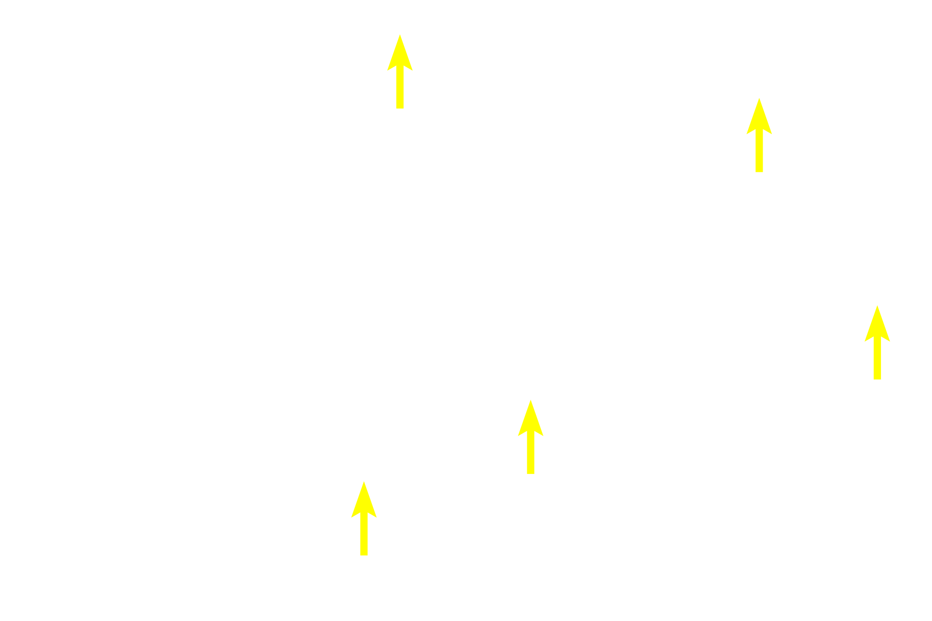  - Sinusoids <p>The lobule, the basic structure of the liver, is formed by anastomosing rows of hepatocytes and intervening sinusoids, which extend from the periphery of the lobule toward a central vein. Portal canals, located at the marginal angles around the perimeter of the lobule, contain branches of the hepatic portal vein, hepatic artery and bile duct. This image of pig liver shows bands of connective tissue outlining lobules; these distinctions are not so obvious in the human. </p>
