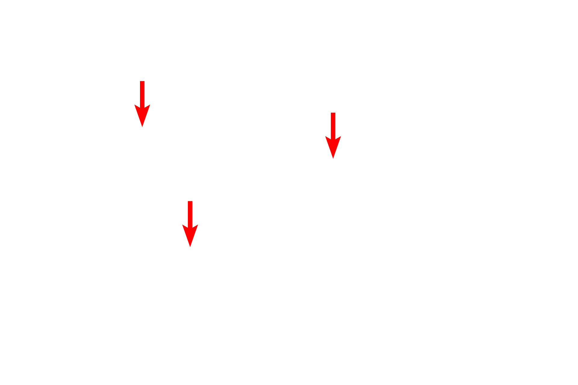  - Rough endoplasmic reticulum <p>Another view of an hepatocyte demonstrates its euchromatic nucleus, numerous mitochondria, and abundant RER and glycogen granules.  Microvilli project into the space of Disse, located adjacent to the fenestrated sinusoids.  10,000x</p>
