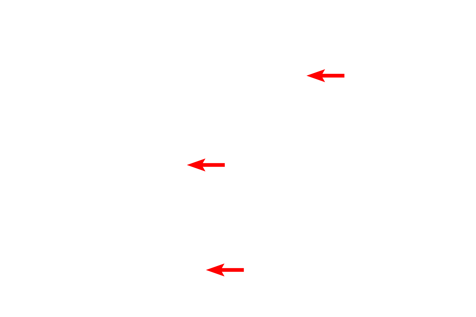 - Mitochondria <p>Another view of an hepatocyte demonstrates its euchromatic nucleus, numerous mitochondria, and abundant RER and glycogen granules.  Microvilli project into the space of Disse, located adjacent to the fenestrated sinusoids.  10,000x</p>
