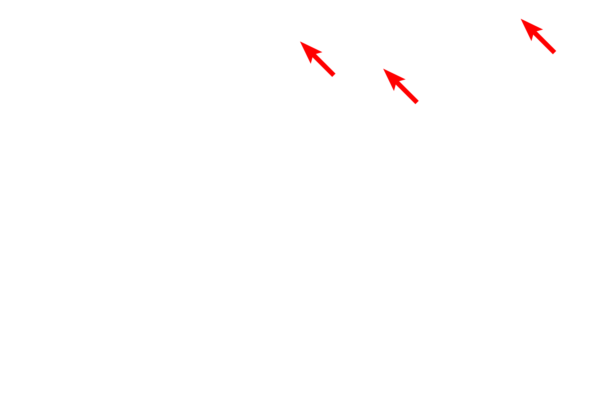  - Microvilli <p>Another view of an hepatocyte demonstrates its euchromatic nucleus, numerous mitochondria, and abundant RER and glycogen granules.  Microvilli project into the space of Disse, located adjacent to the fenestrated sinusoids.  10,000x</p>
