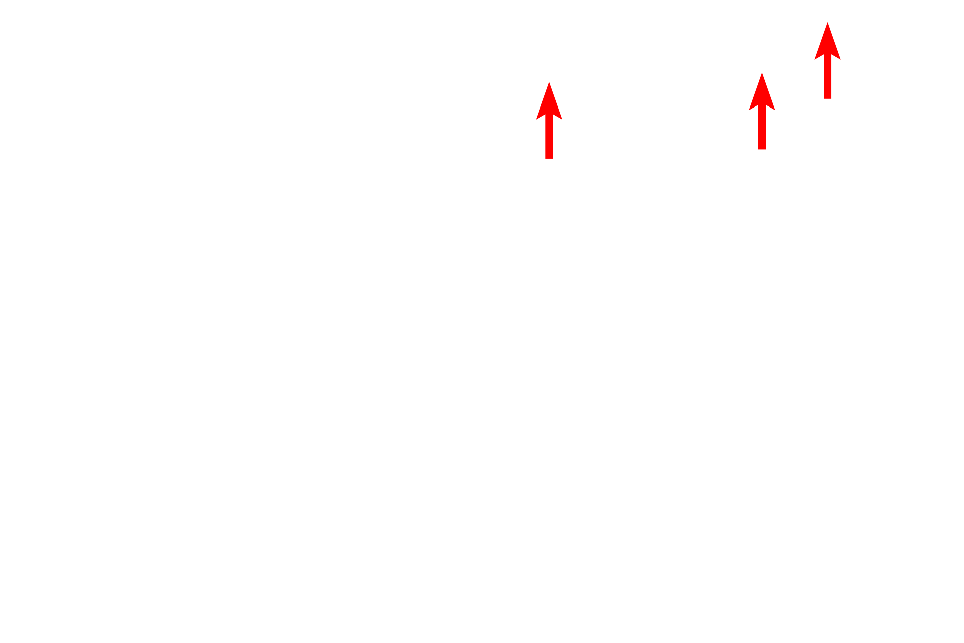 Space of Disse <p>Another view of an hepatocyte demonstrates its euchromatic nucleus, numerous mitochondria, and abundant RER and glycogen granules.  Microvilli project into the space of Disse, located adjacent to the fenestrated sinusoids.  10,000x</p>
