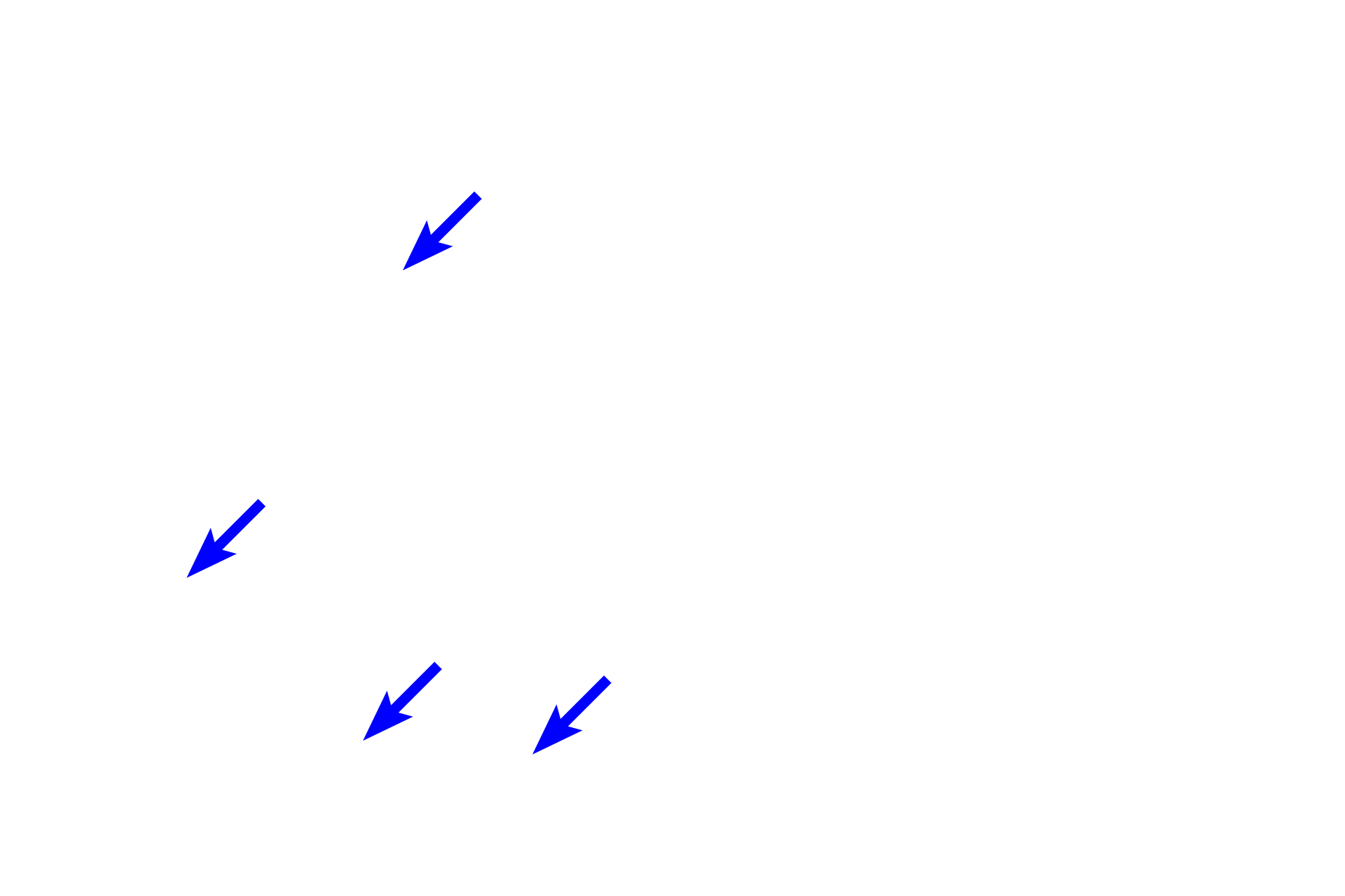 Sinusoids <p>Bile, the exocrine liver product, is released into tiny tunnel-like passageways called bile canaliculi.  Canaliculi are located between the boundaries of adjacent hepatocytes and are continuous with bile ducts in the hepatic portal canals.  Bile drains from the canaliculus to the bile duct, passing through an enlarging duct system and finally opening into the duodenum.  The right image shows a preparation where the bile duct system has been injected with dye.  800x, 800x</p>
