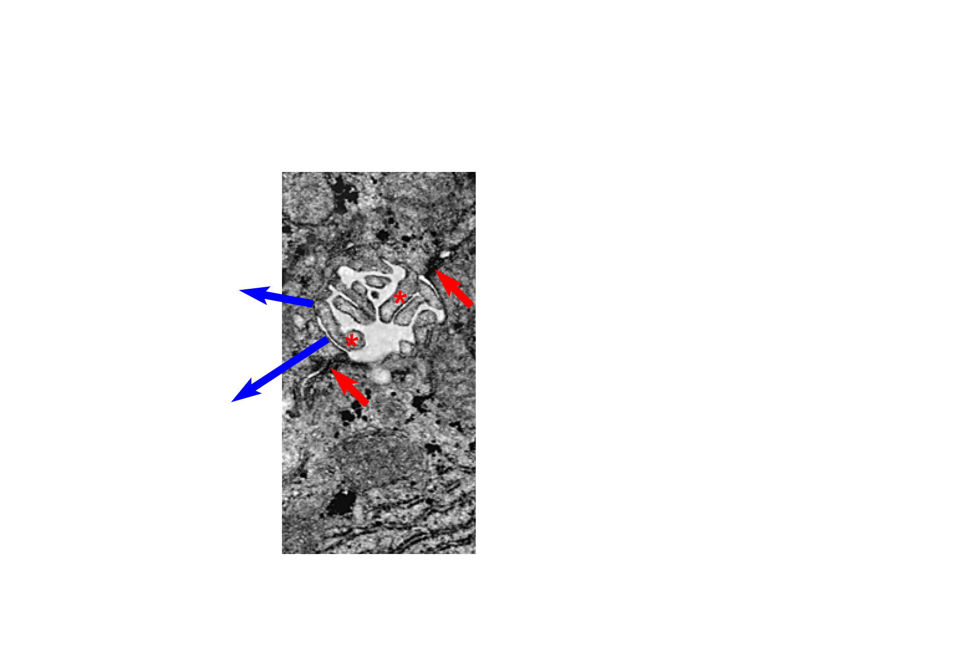  - Ultrastructure of the bile canaliculus > <p>Hepatocyte cell membranes bulge inward to form the canaliculus.  Bile is restricted to the canaliculus by junctional complexes (red arrows) at its periphery. Adjacent hepatocytes extend microvilli (asterisks) into the lumen of the canaliculus, which is isolated from the extracellular space by the junctional complexes.  50,000x</p>
