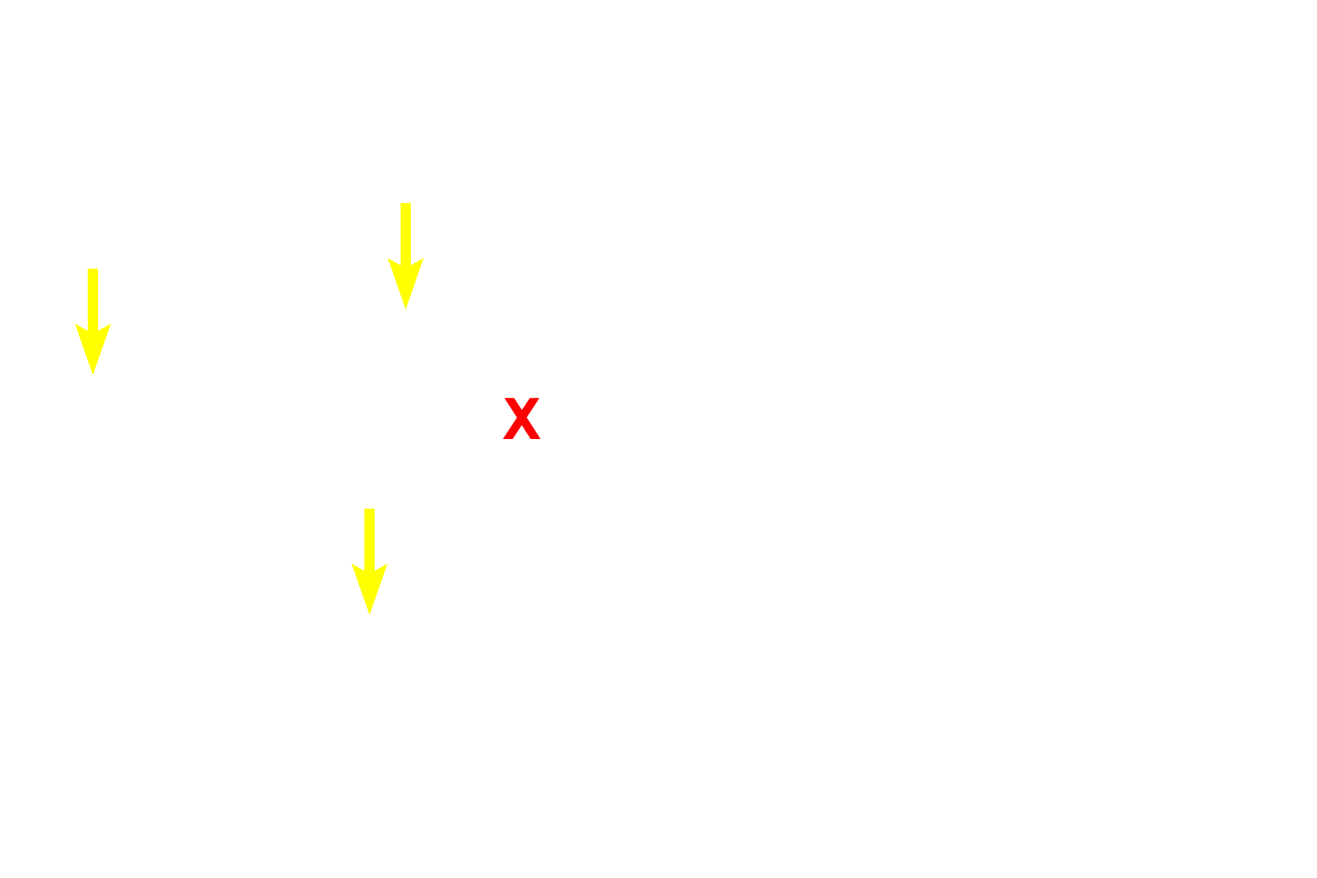  - Hepatocyte nuclei <p>The liver functions in glycogen storage and mobilization.  These images compare the light microscopic appearance of glycogen in a PAS-stained section (left) with that seen by electron microscopy (right).  About 75% of the blood that enters the liver does so via the hepatic portal vein, which directly drains the organs of the digestive tract.  Thus, the liver is the first organ to receive absorbed nutrients.  1000x, 15,000x</p>
