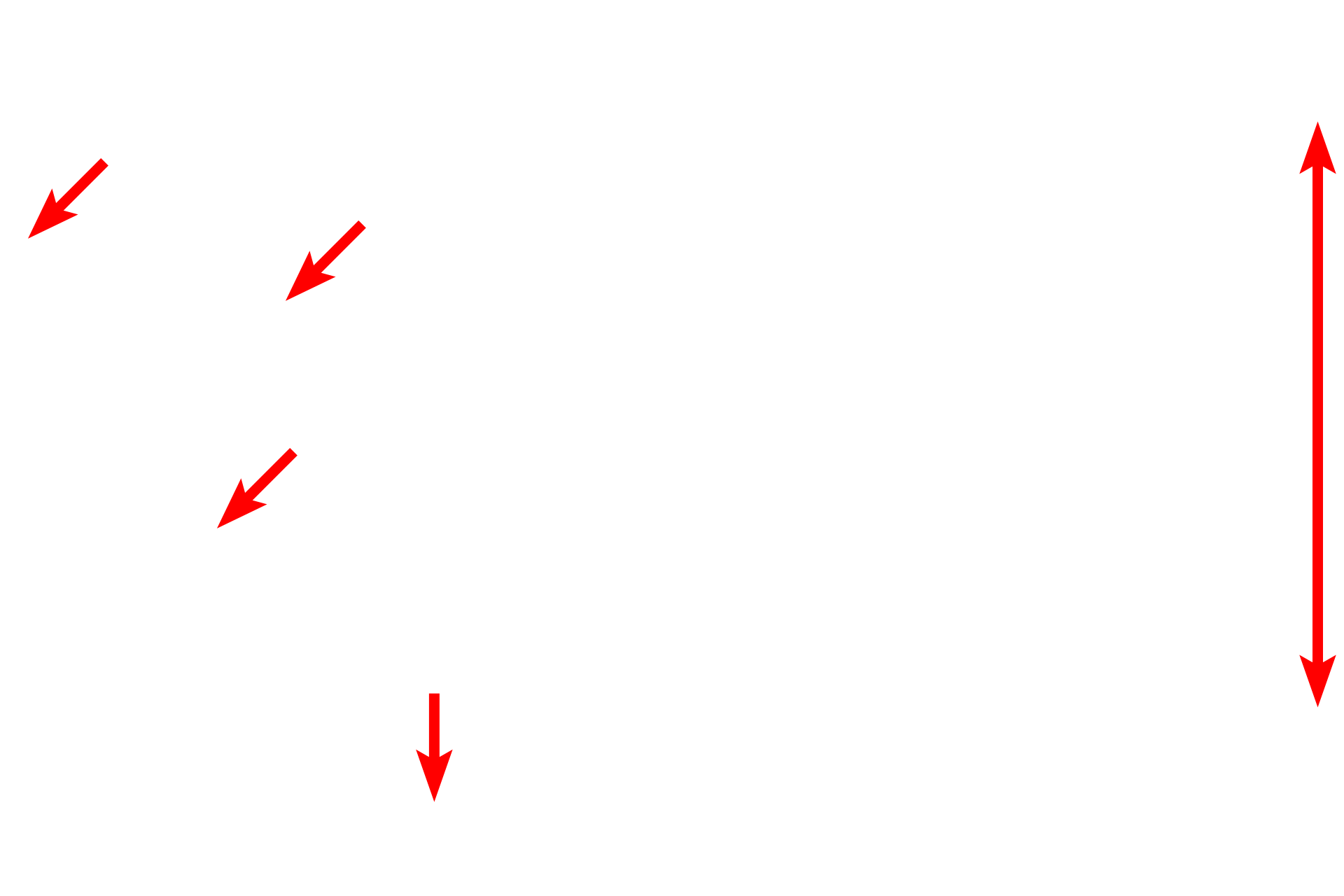 Sinusoids <p>The liver functions in glycogen storage and mobilization.  These images compare the light microscopic appearance of glycogen in a PAS-stained section (left) with that seen by electron microscopy (right).  About 75% of the blood that enters the liver does so via the hepatic portal vein, which directly drains the organs of the digestive tract.  Thus, the liver is the first organ to receive absorbed nutrients.  1000x, 15,000x</p>
