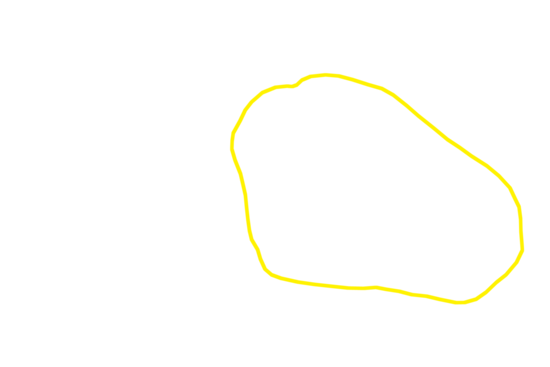 Liver lobule <p>The classic liver lobule is more clearly demarcated by connective tissue in a pig than in the human.  Blood enters the liver in the hepatic portal vein or hepatic artery; branches of both vessels are located in a portal canal.  From these branches, blood enters hepatic sinusoids between plates of hepatocytes and is carried into the central vein.  Bile is produced by the hepatocytes and flows in bile canaliculi toward the periphery of the lobule where it enters branches of the bile duct.  100x</p>
