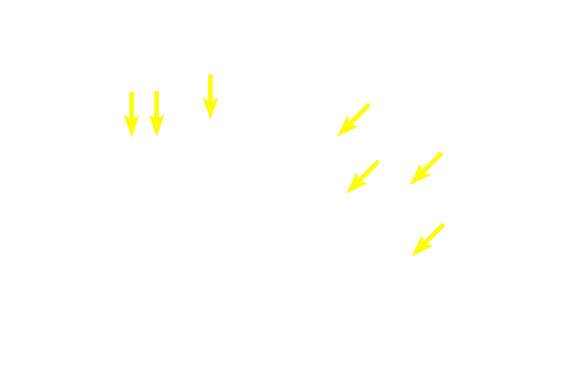 Hepatocytes <p>The classic liver lobule is more clearly demarcated by connective tissue in a pig than in the human.  Blood enters the liver in the hepatic portal vein or hepatic artery; branches of both vessels are located in a portal canal.  From these branches, blood enters hepatic sinusoids between plates of hepatocytes and is carried into the central vein.  Bile is produced by the hepatocytes and flows in bile canaliculi toward the periphery of the lobule where it enters branches of the bile duct.  100x</p>
