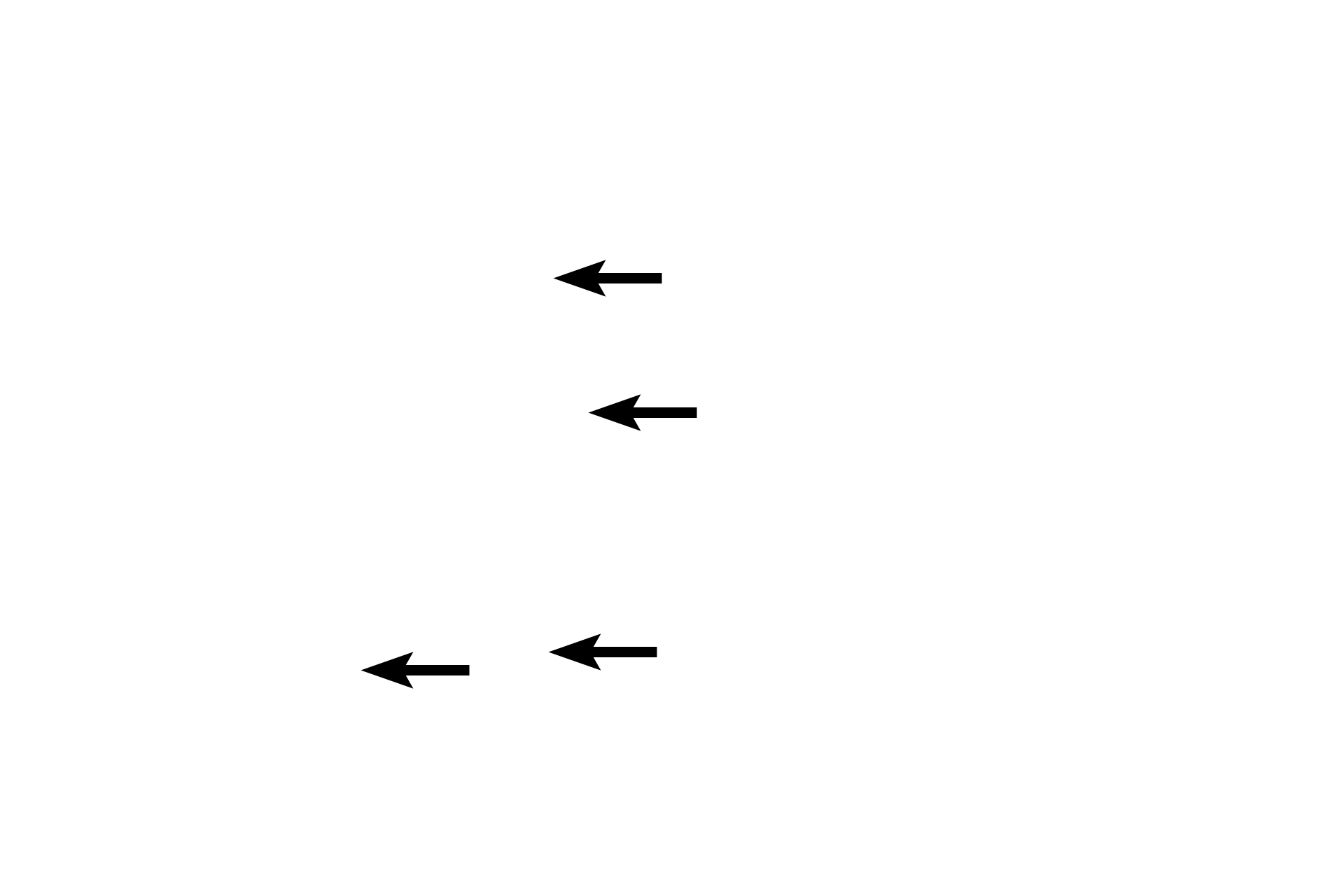 Sinusoids <p>Connective tissue partitions surrounding lobules are minimal in primates, shown here, making lobules and portal canals more difficult to distinguish.  100x</p>
