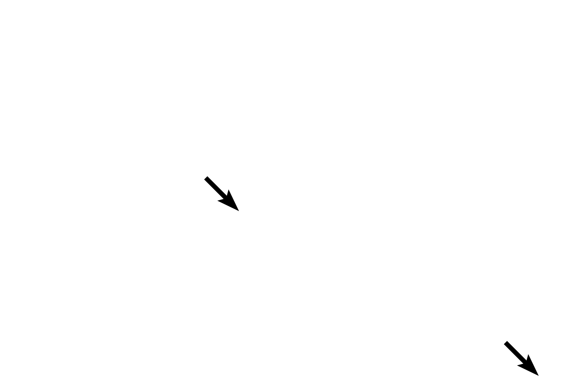 Central veins <p>Connective tissue partitions surrounding lobules are minimal in primates, shown here, making lobules and portal canals more difficult to distinguish.  100x</p>
