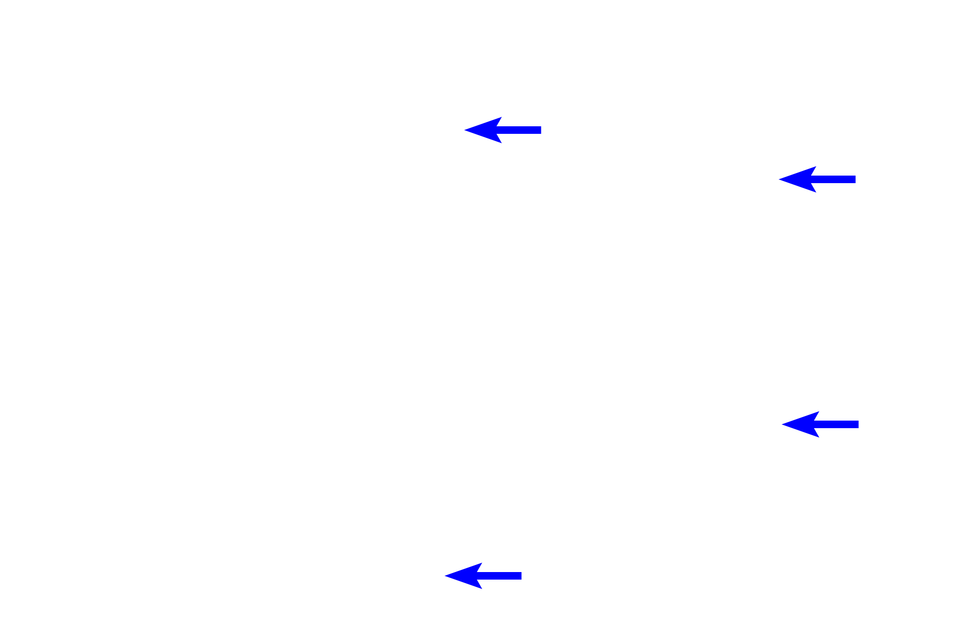 Liver sinusoids <p>A central vein is located at the center of a classic liver lobule.  The central vein receives blood from the hepatic sinusoids separating plates of hepatocytes.  These plates form anastomosing rows that radiate out from the central vein.  Central veins anastomose to form three hepatic veins that drain into the inferior vena cava.  800x</p>
