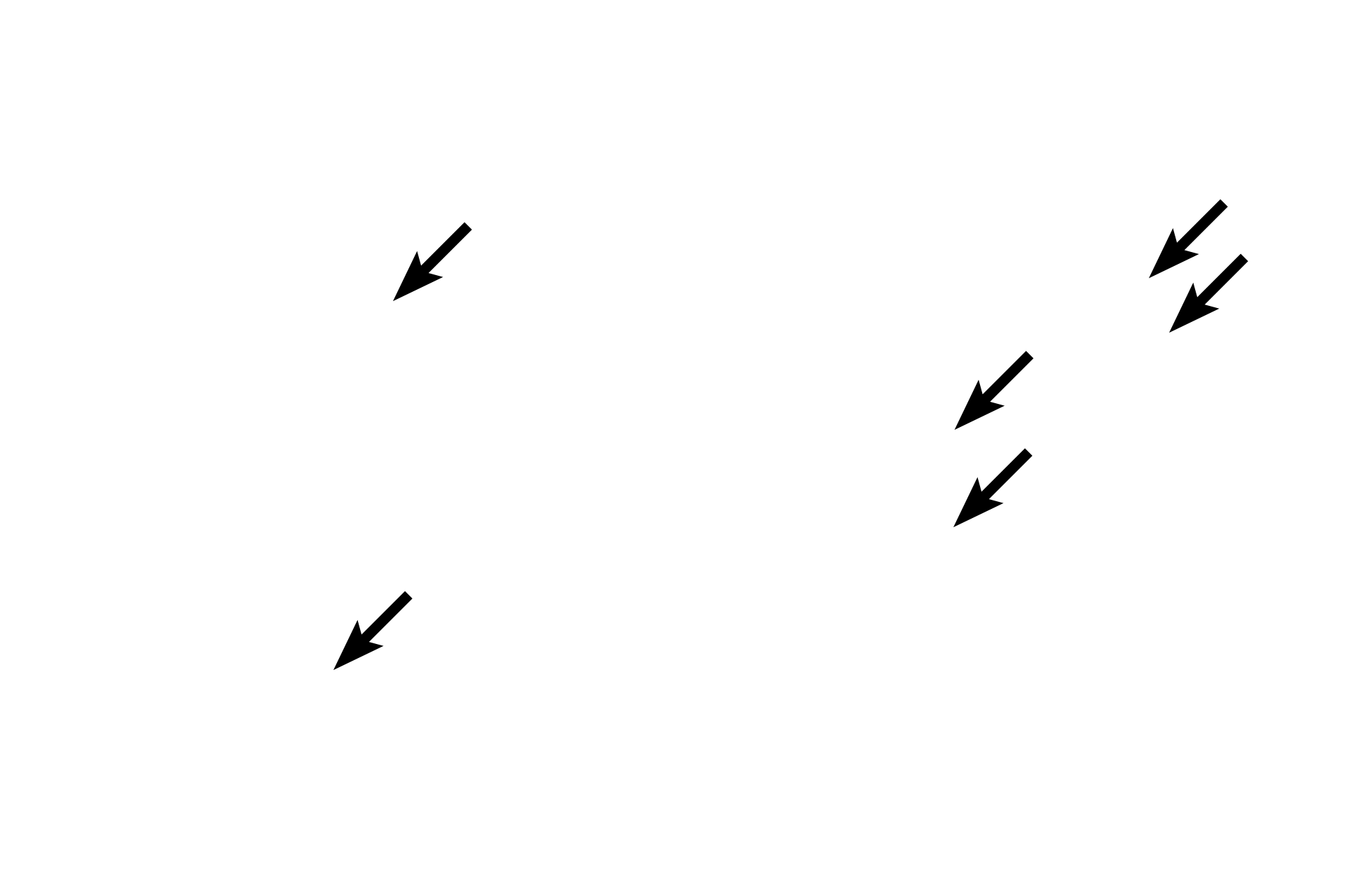 Kupffer cells > <p>Kupffer cells belong to the mononuclear phagocyte series of phagocytic cells, which include macrophages, Langherhans cells in the skin, osteoclasts and alveolar macrophages.</p>
