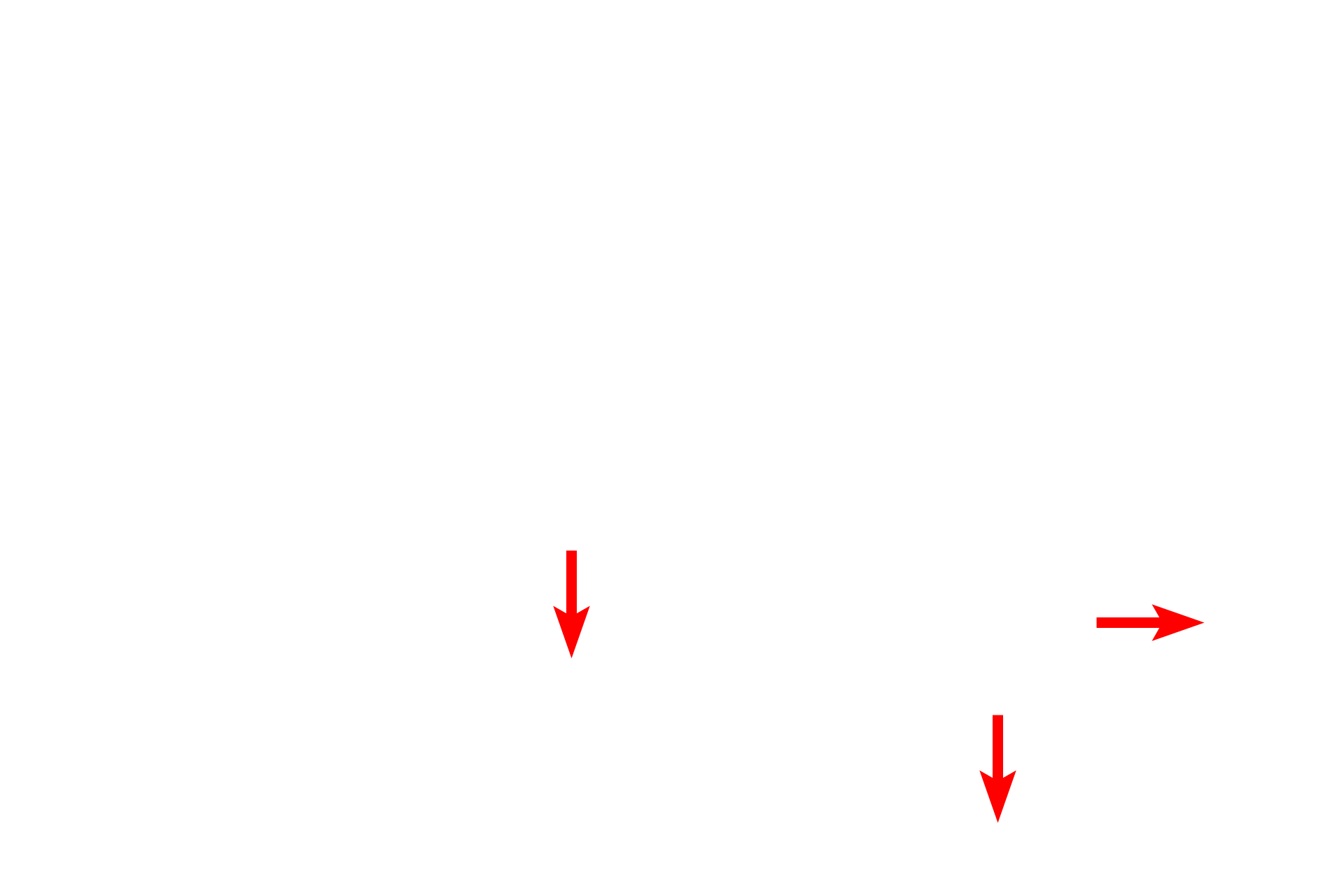 Endothelium <p>Sinusoids, discontinuous capillaries, are lined by a fenestrated endothelium with additional gaps between adjacent cells.  The discontinuous basal lamina allows easy access between the sinusoid and the space of Disse, located between sinusoids and adjacent hepatocytes.  Kupffer cells (liver macrophages) span sinusoids, phagocytosing aged erythrocytes and debris.  5000x</p>
