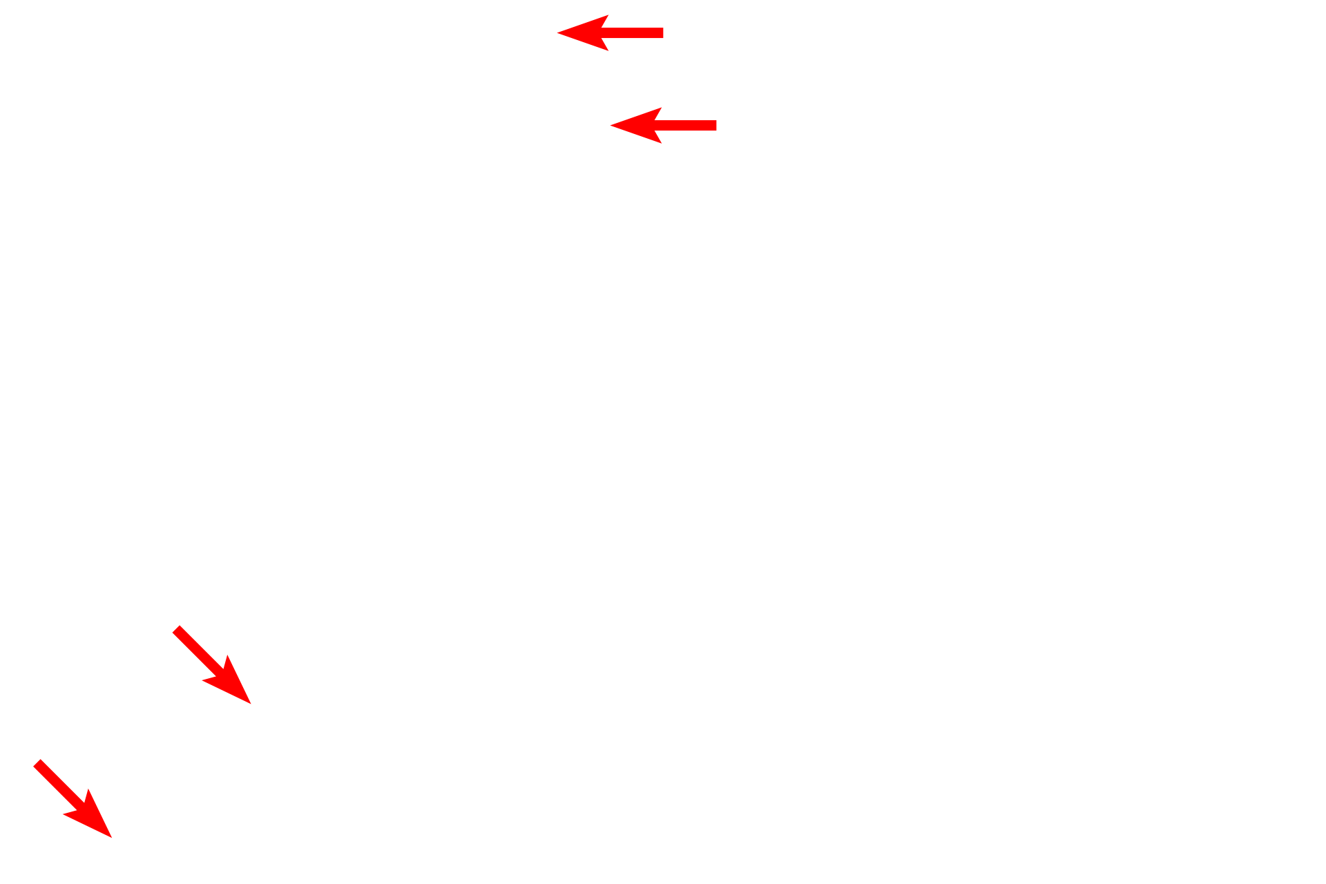  - Cell margins <p>Sinusoids, discontinuous capillaries, are lined by a fenestrated endothelium with additional gaps between adjacent cells.  The discontinuous basal lamina allows easy access between the sinusoid and the space of Disse, located between sinusoids and adjacent hepatocytes.  Kupffer cells (liver macrophages) span sinusoids, phagocytosing aged erythrocytes and debris.  5000x</p>

