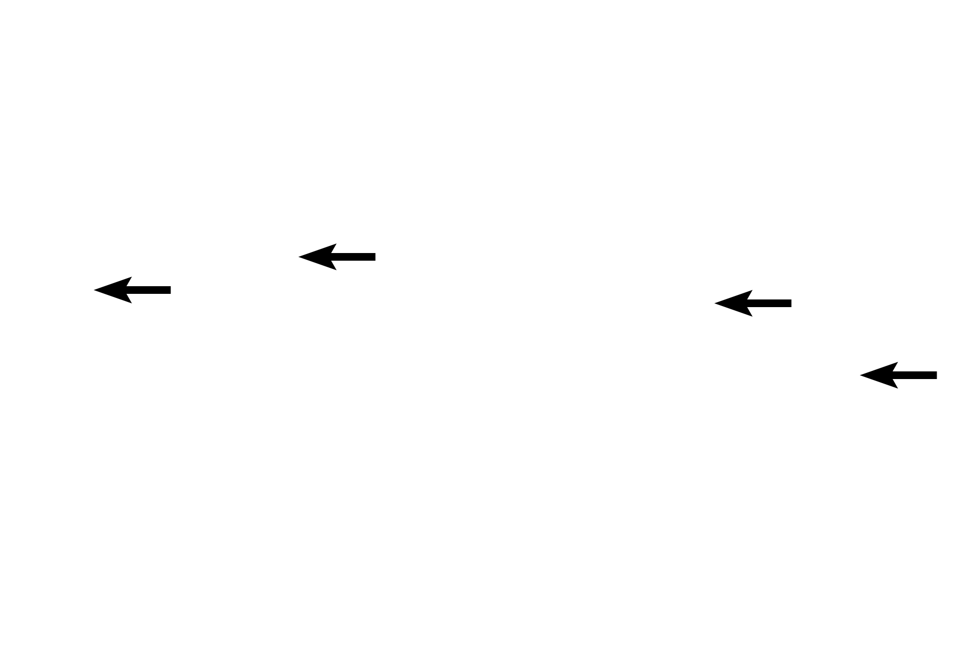 Capillaries <p>The endocrine cells of the islet are arranged in plates or cords with intervening capillaries.  The islet is surrounded by the exocrine pancreas, composed of spherical acini.</p>
