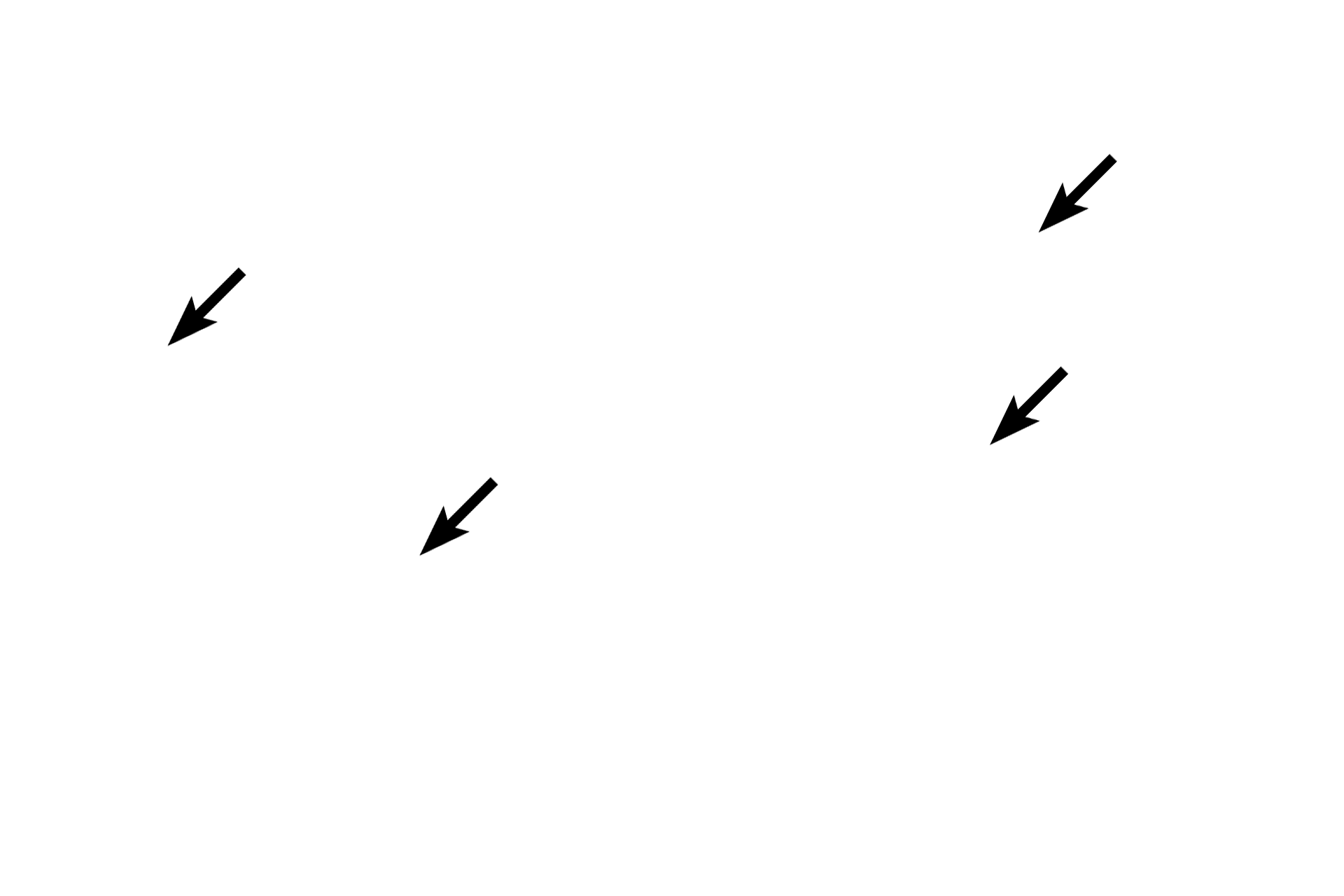 Endocrine cells > <p>The endocrine cells of the islet are arranged in plates or cords with intervening capillaries.  The islet is surrounded by the exocrine pancreas, composed of spherical acini.</p>
