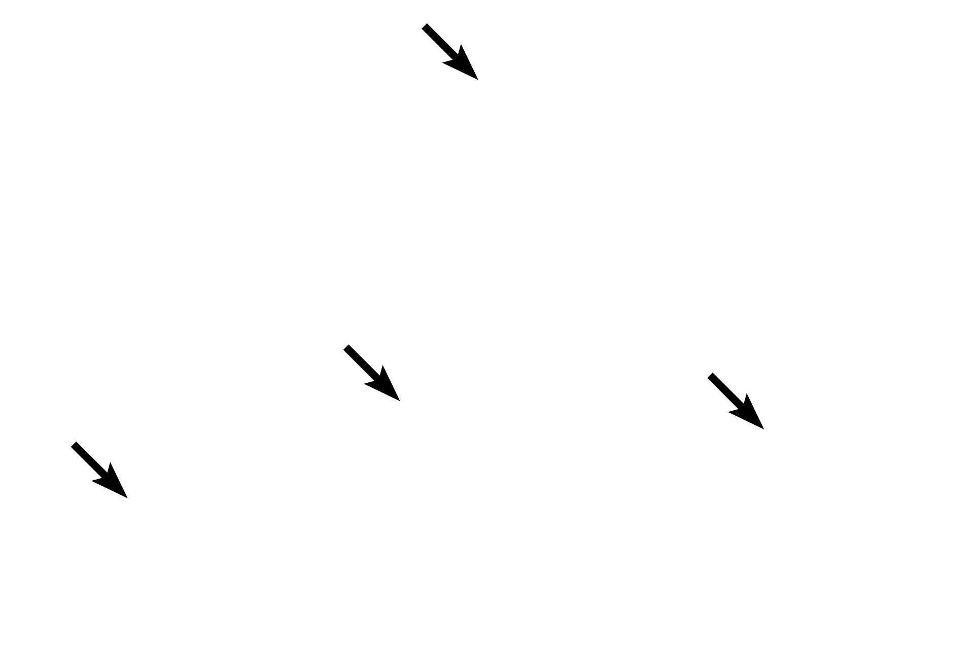 Acini <p>The endocrine cells of the islet are arranged in plates or cords with intervening capillaries.  The islet is surrounded by the exocrine pancreas, composed of spherical acini.</p>
