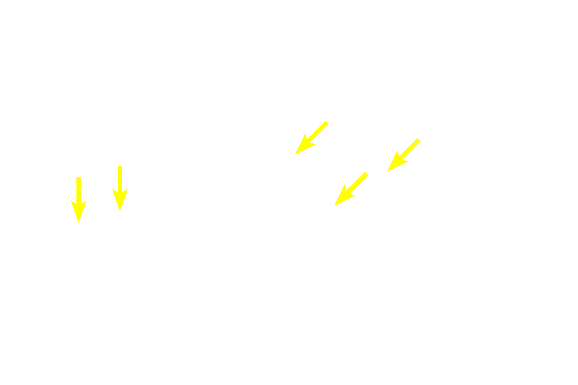Capillaries with red blood cells <p>An islet of Langerhans, the endocrine portion of the pancreas, is surrounded by serous acini and intercalated ducts of the exocrine portion.  Although individual endocrine cell types cannot be differentiated with this stain, numerous capillaries and the organization of cells in plates or cords adjacent to the capillaries, reflect the endocrine characteristics of the islet.  400x</p>
