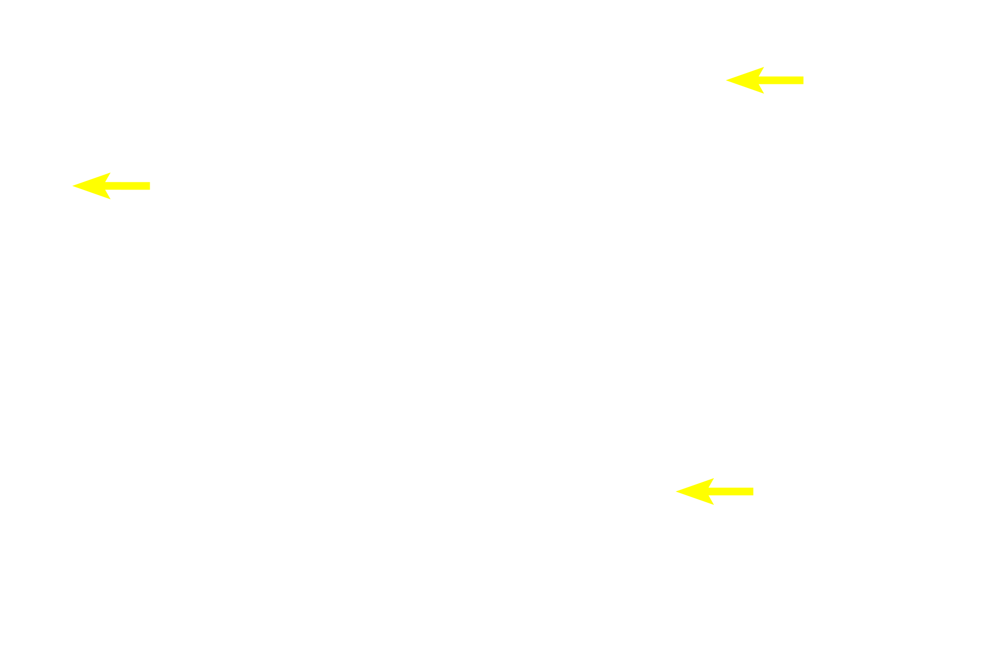 Acini <p>An islet of Langerhans, the endocrine portion of the pancreas, is surrounded by serous acini and intercalated ducts of the exocrine portion.  Although individual endocrine cell types cannot be differentiated with this stain, numerous capillaries and the organization of cells in plates or cords adjacent to the capillaries, reflect the endocrine characteristics of the islet.  400x</p>
