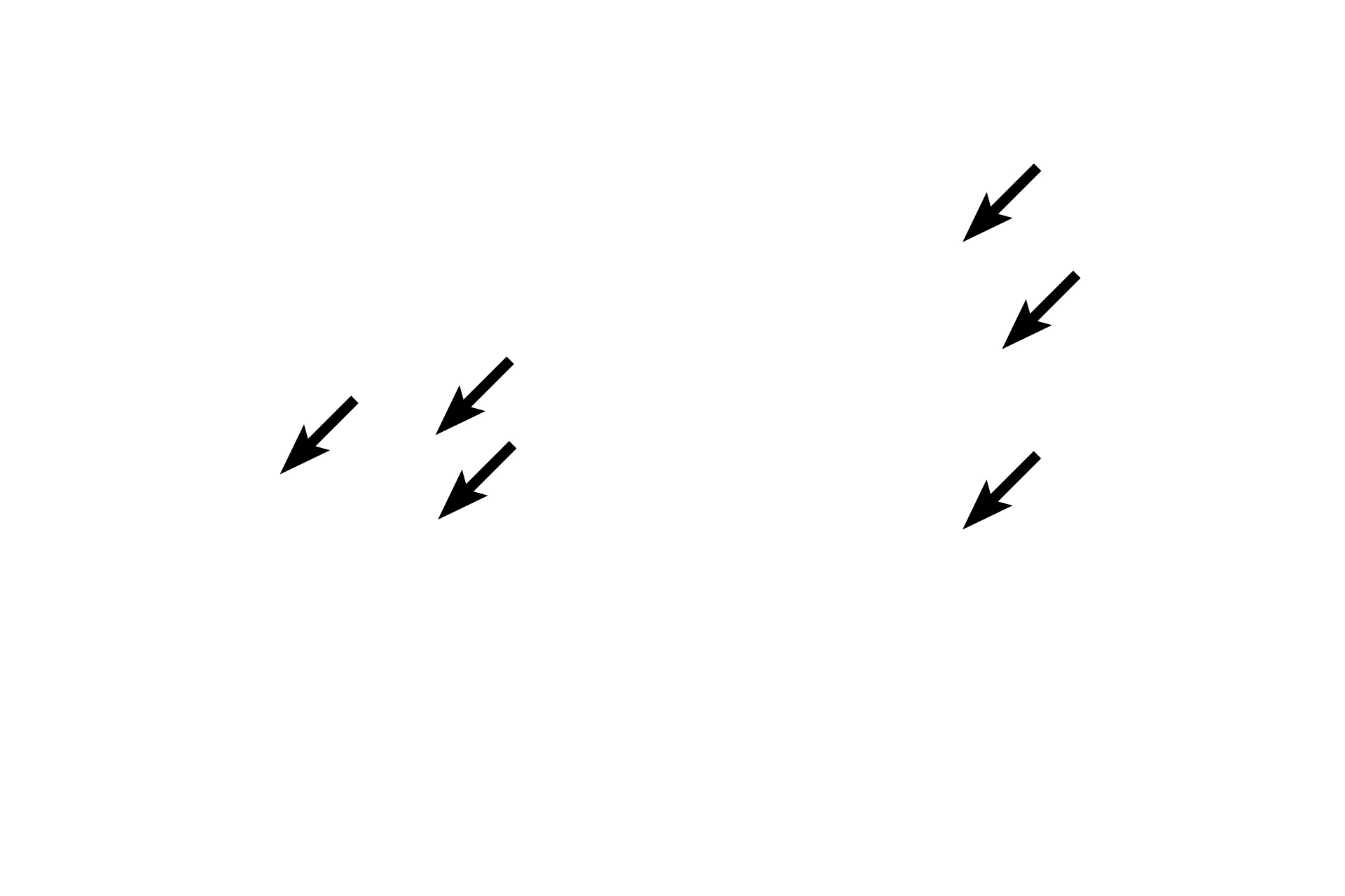  - Endocrine cells <p>For this tissue preparation, the vascular supply was injected with a red dye to highlight the large number of capillaries present in the islets of Langerhans. The capillaries receive the islet hormones for distribution throughout the body, as well as deliver metabolic and hormonal signals to the islet cells to regulate their secretion. 400x</p>

