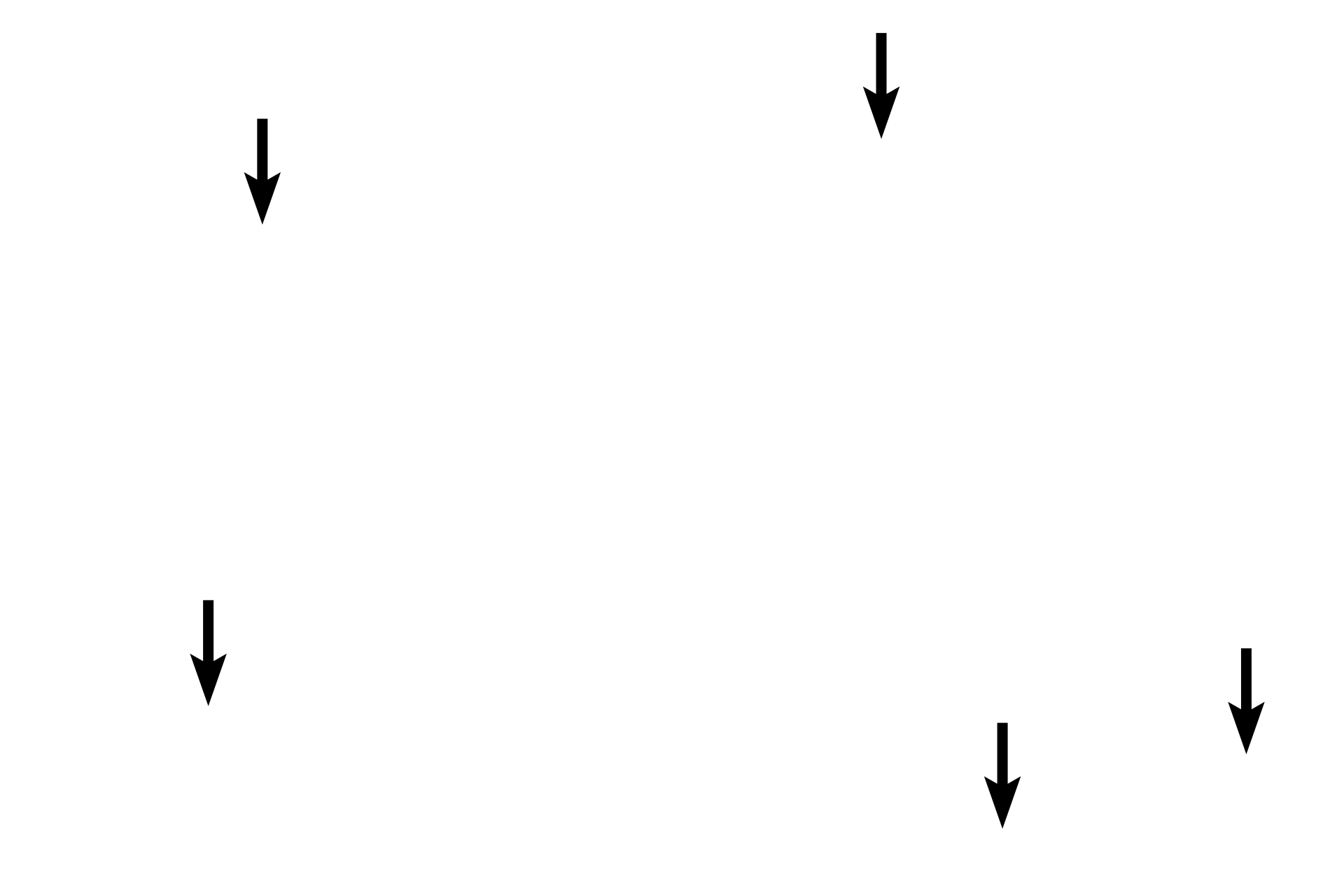 Acini > <p>Acinar cells secrete their digestive enzymes through a duct system that eventually opens into the lumen of the duodenum.</p>
