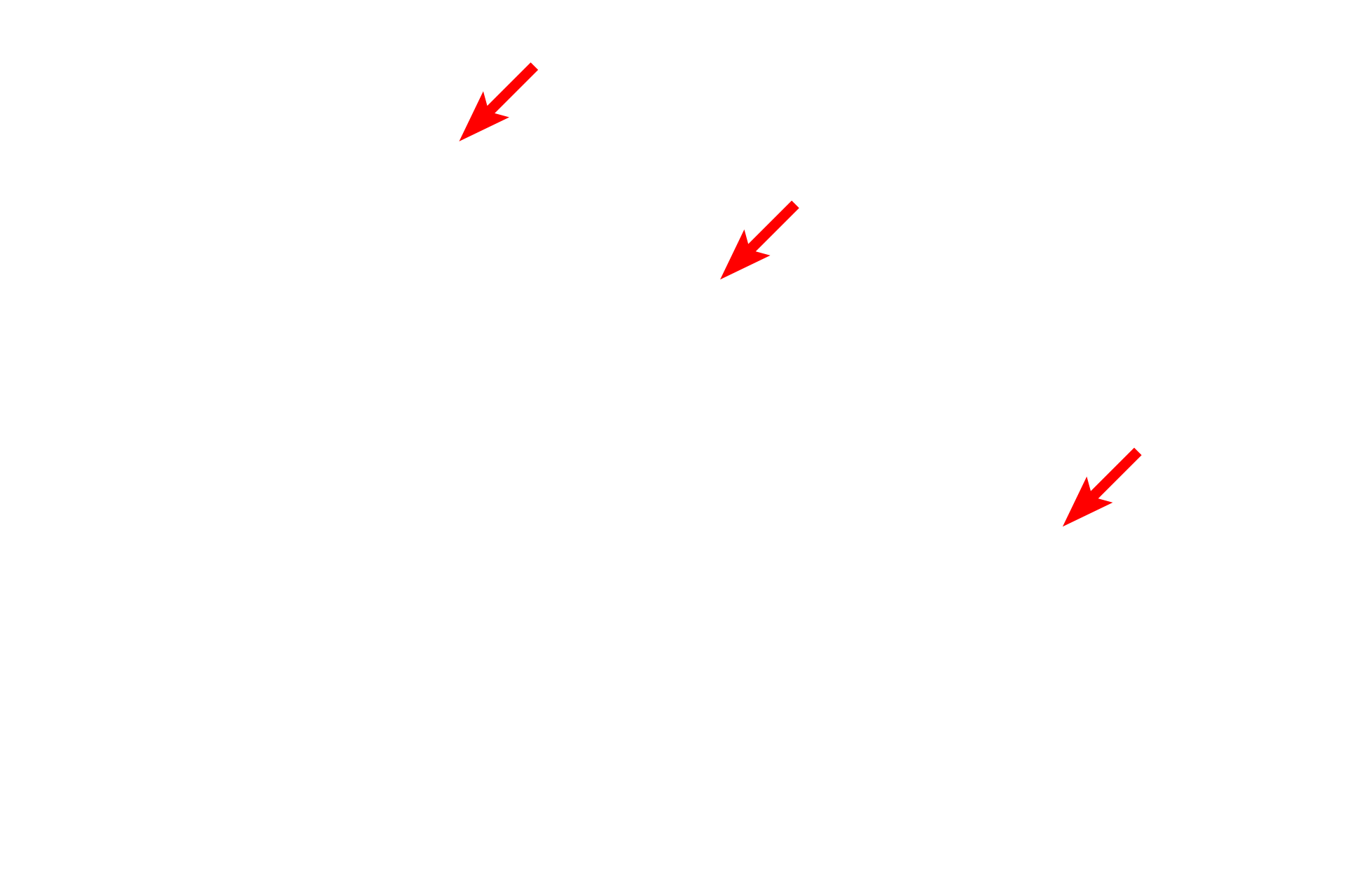  - Endothelial cell <p>Because the islets of Langerhans are endocrine cell clusters, they are supplied by fenestrated capillaries.  A fenestrated capillary lies adjacent to an endocrine secretory cell.  10,000x</p>
