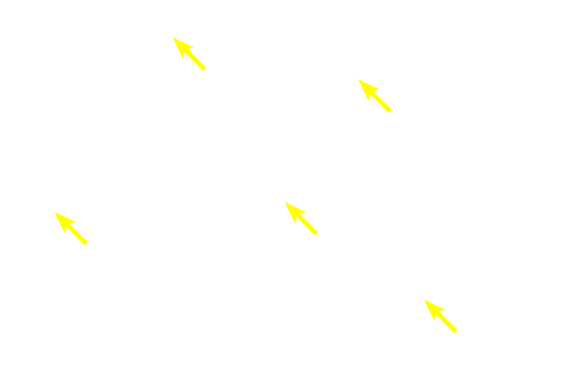 Acini <p>The cells of the exocrine pancreas are located in discretely organized acini, whereas cells of the endocrine pancreas are represented by highly vascularized cell clusters called islets of Langerhans.<br />
 100x</p>
