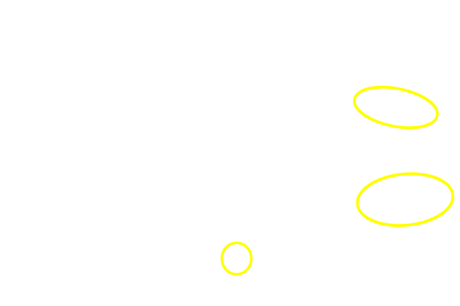 Islets of Langerhans <p>The cells of the exocrine pancreas are located in discretely organized acini, whereas cells of the endocrine pancreas are represented by highly vascularized cell clusters called islets of Langerhans.<br />
 100x</p>
