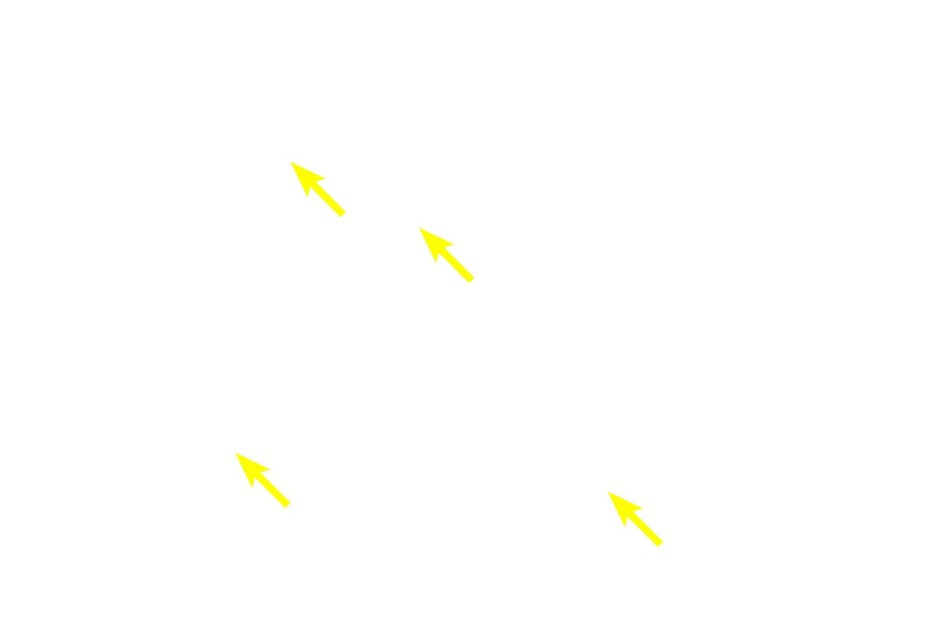  - Basal rough endoplasmic reticulum > <p>The acinar cells of the exocrine pancreas synthesize digestive enzymes in basally-located rough endoplasmic reticulum.  The enzymes, in their inactive form, are packaged into secretory granules and then released into the duct system.  The enzymes are not activated until they reach the lumen of the duodenum.</p>
