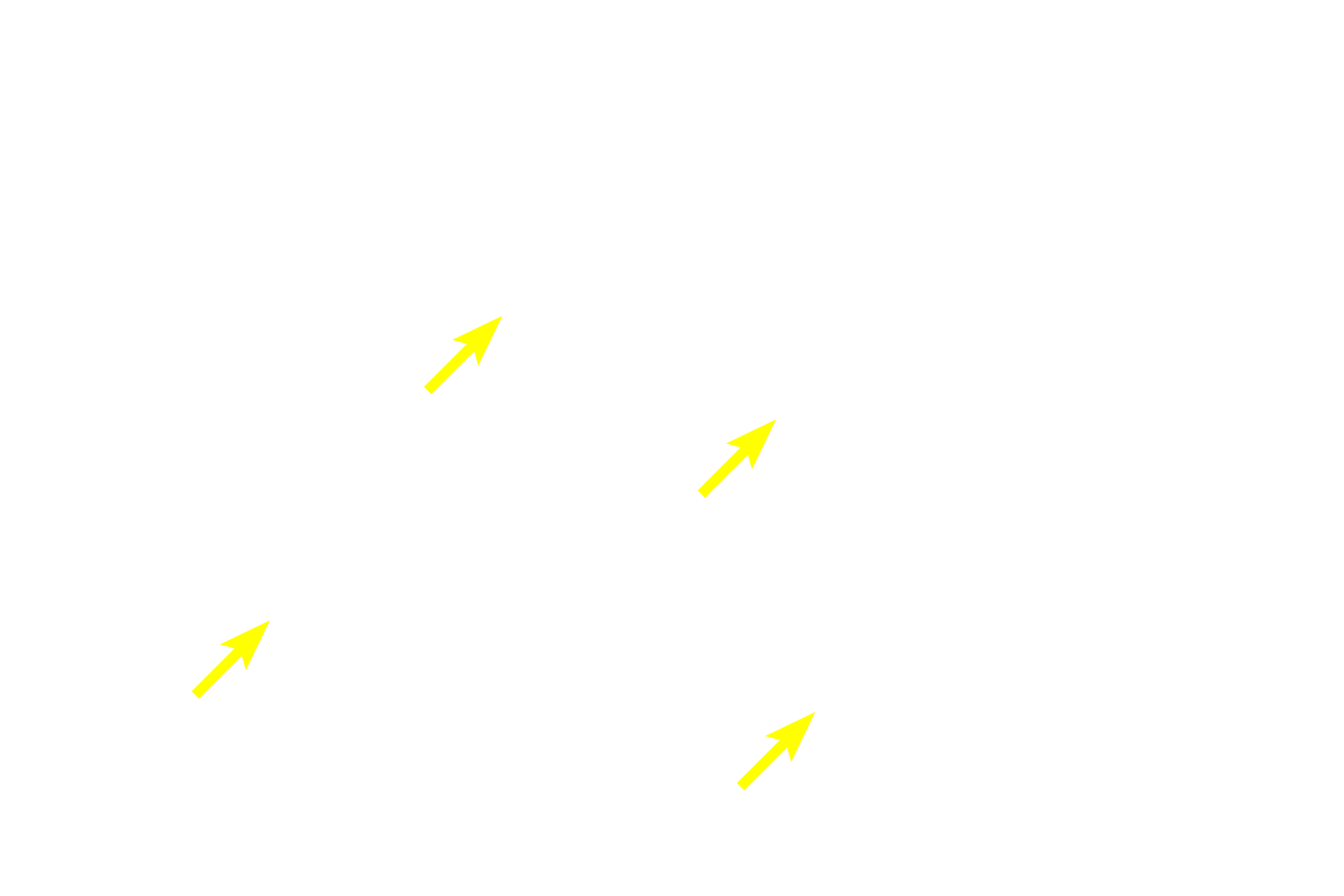  - Secretory granules <p>The acinar cells of the exocrine pancreas synthesize digestive enzymes in basally-located rough endoplasmic reticulum.  The enzymes, in their inactive form, are packaged into secretory granules and then released into the duct system.  The enzymes are not activated until they reach the lumen of the duodenum.</p>
