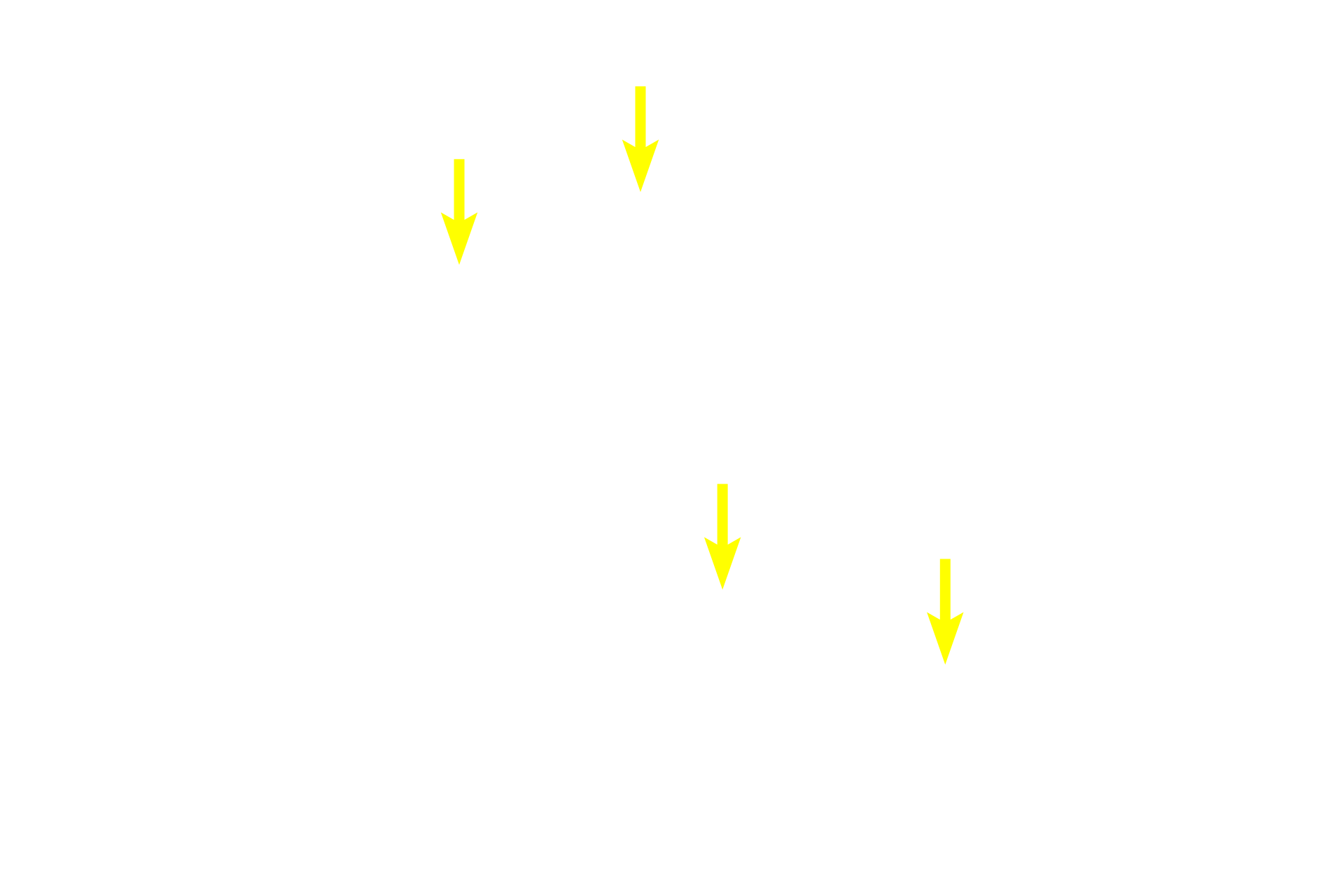  - Centroacinar cells > <p>A unique feature of the exocrine pancreas is that the smallest duct (intralobular duct) begins with centroacinar cells located within the center of the acinus. Intercalated ducts transport bicarbonate and water into their lumens.</p>
