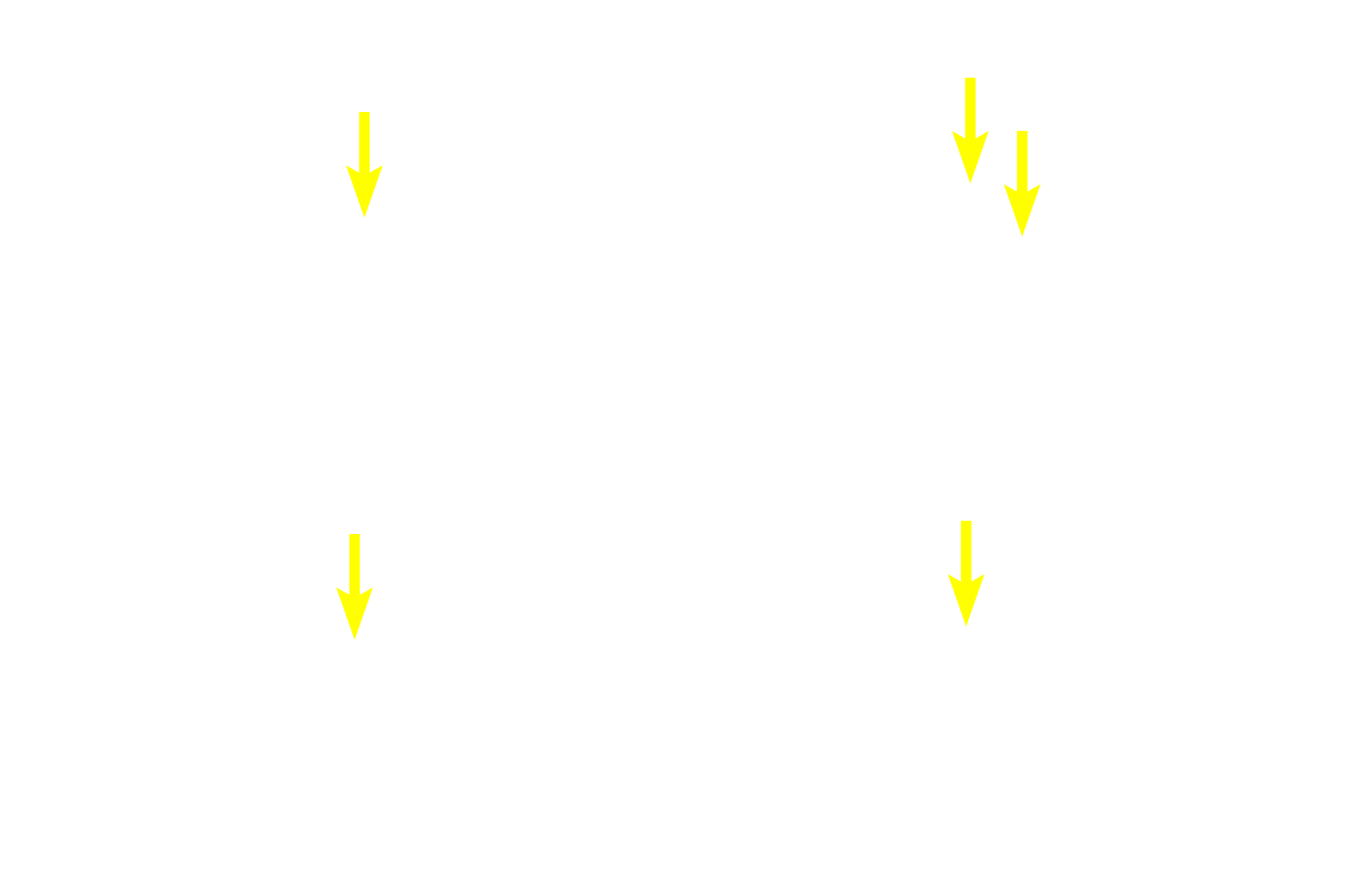 Centroacinar cells <p>Images of acini show the beginning of the duct system starting with the centroacinar cells.  In the top row, centroacinar cells are seen in the center of the acinus.  In the bottom row, the first portion of the intercalated duct is visible as well as its continuity with the centroacinar cells.  1000x</p>
