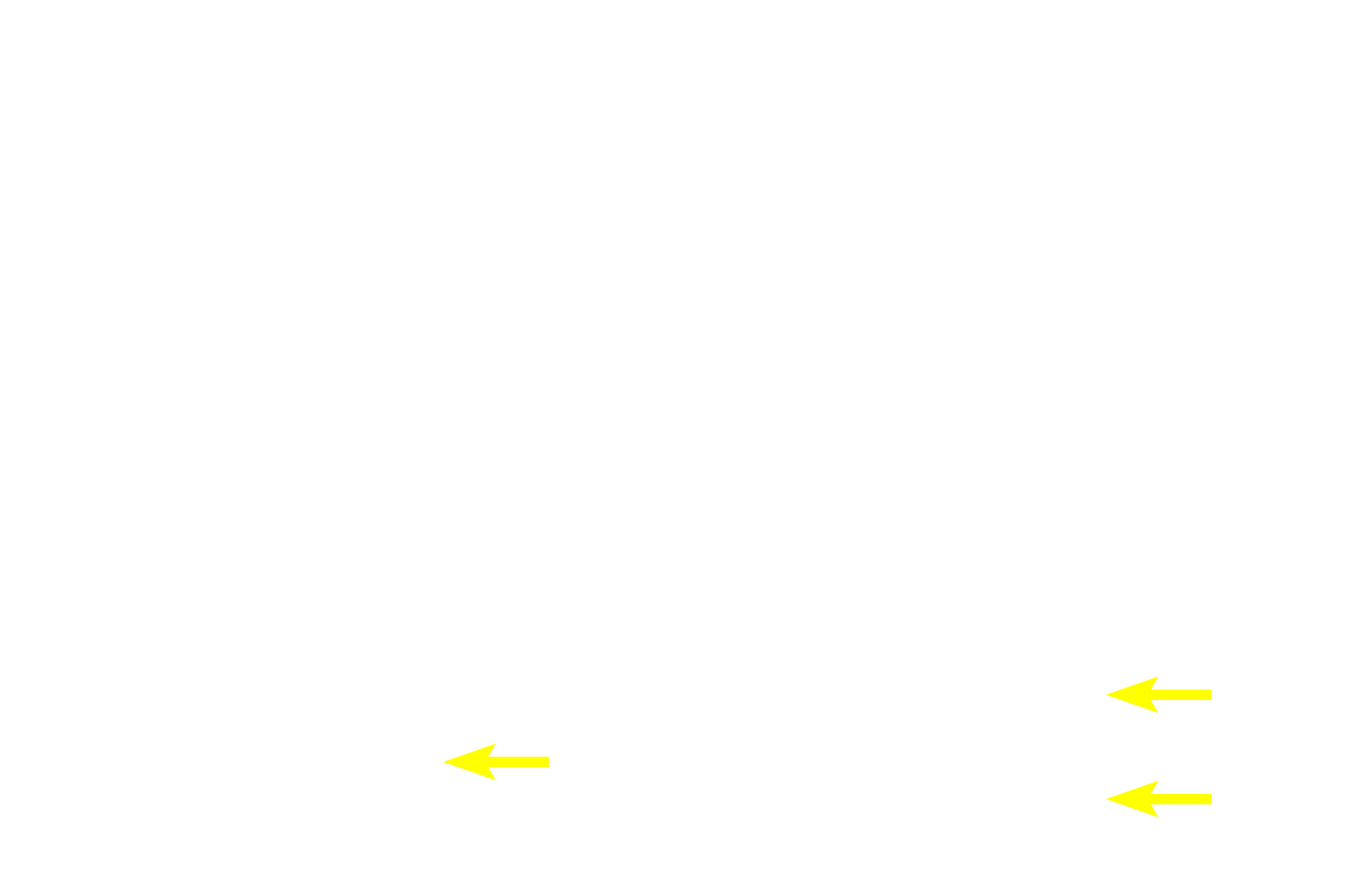 Intercalated duct cells <p>Images of acini show the beginning of the duct system starting with the centroacinar cells.  In the top row, centroacinar cells are seen in the center of the acinus.  In the bottom row, the first portion of the intercalated duct is visible as well as its continuity with the centroacinar cells.  1000x</p>
