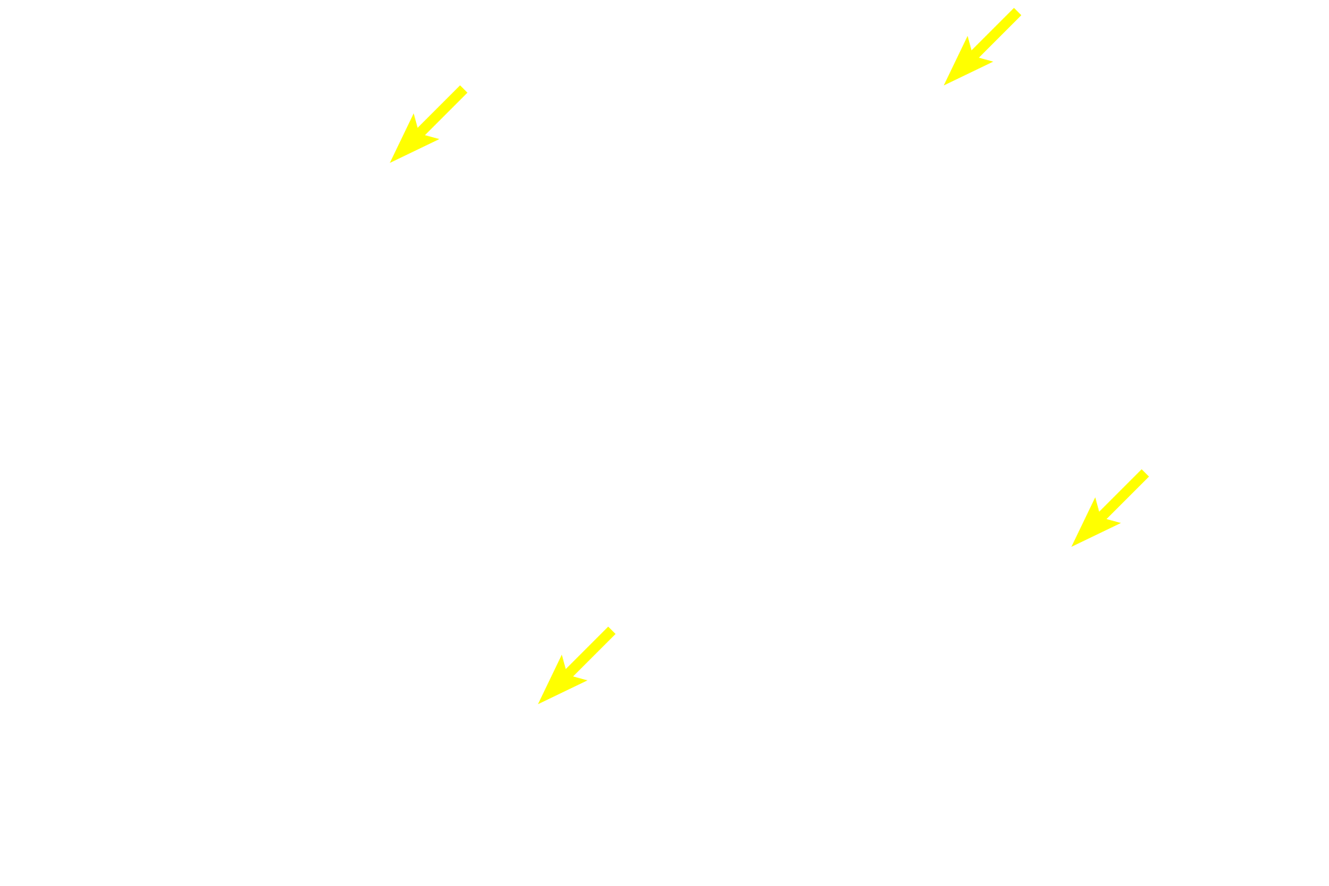 Rough endoplasmic reticulum <p>Images of acini show the beginning of the duct system starting with the centroacinar cells.  In the top row, centroacinar cells are seen in the center of the acinus.  In the bottom row, the first portion of the intercalated duct is visible as well as its continuity with the centroacinar cells.  1000x</p>
